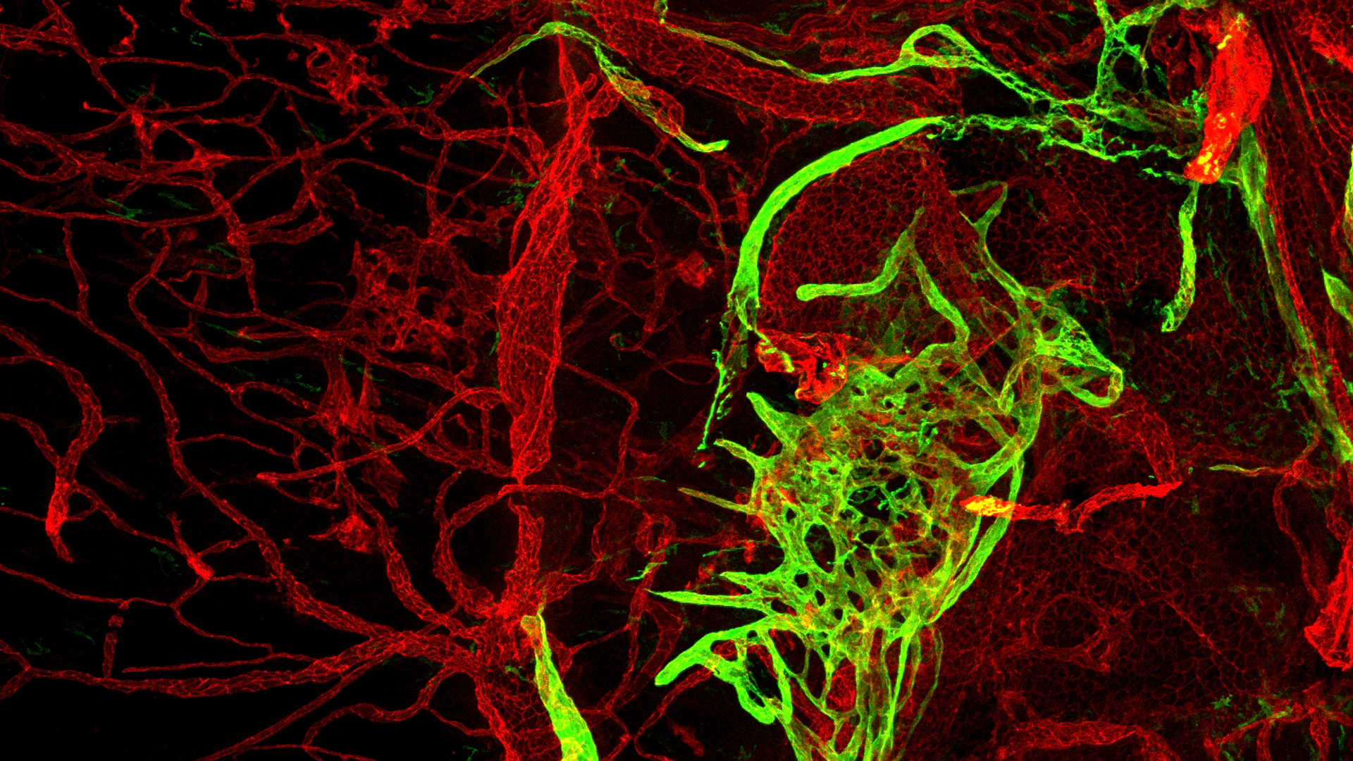 Photo of meningeal lymphatic vessels around petrosquamous sinus cells