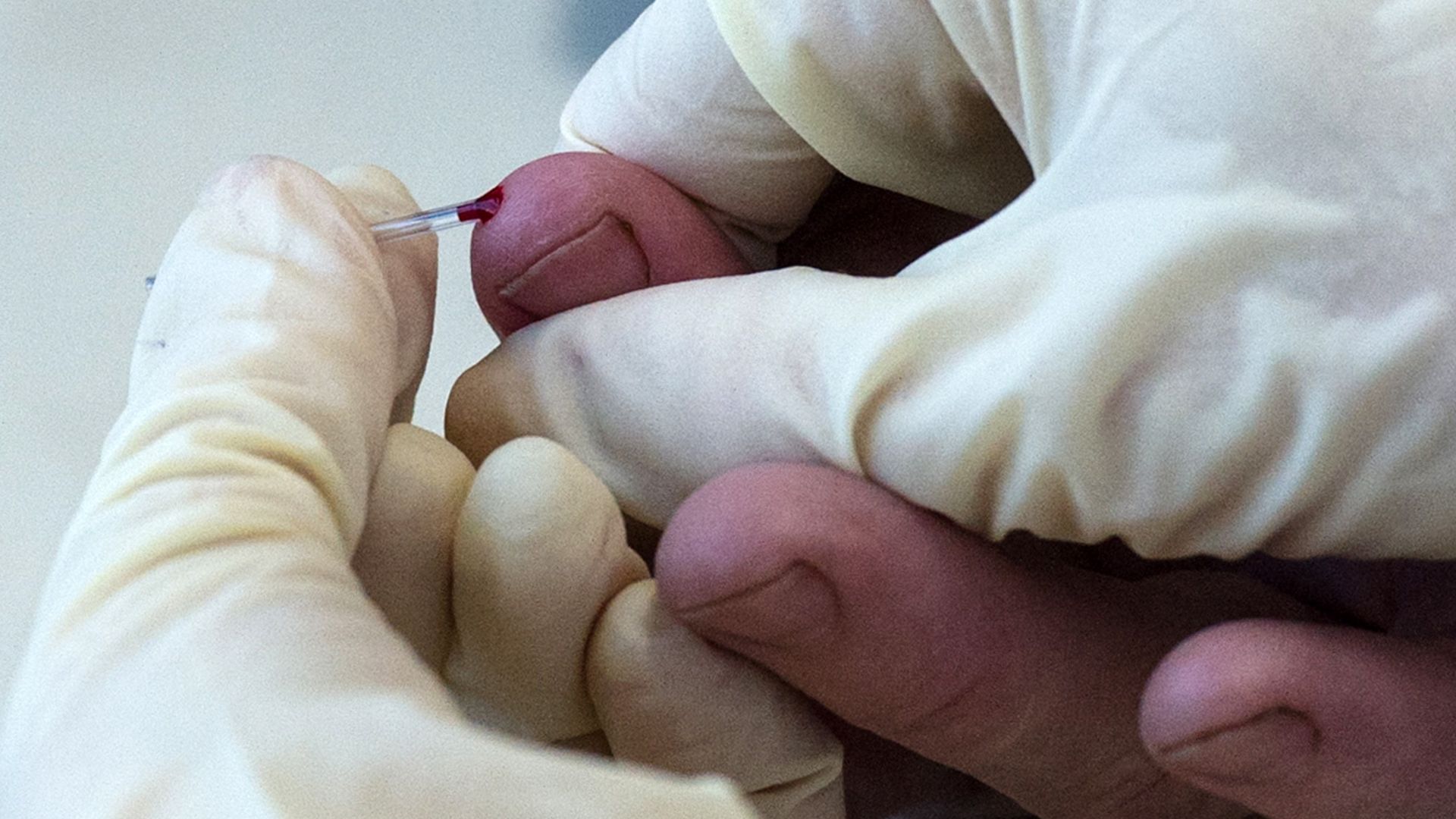 Collecting blood samples at a medical centre that travels by train across the Krasnoyarsk Territory of Russia to provide care to residents in remote areas.