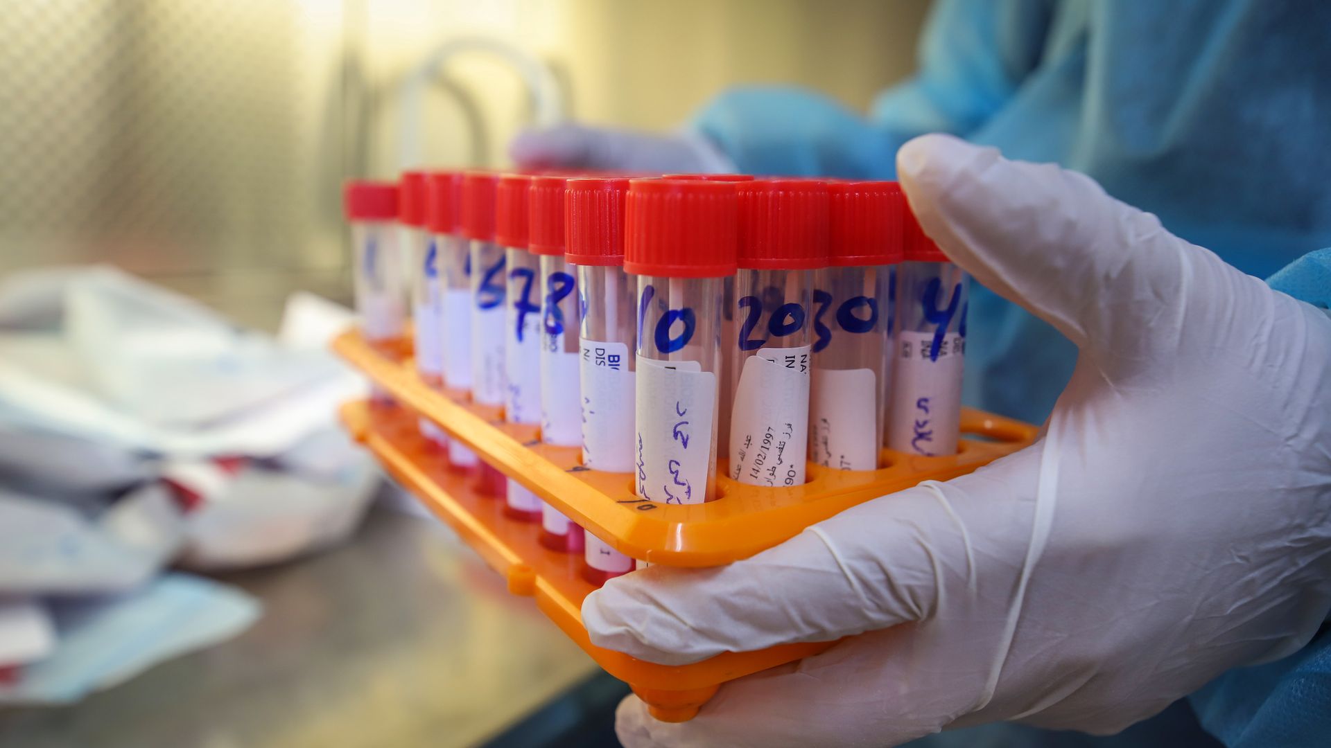 A technician handles tubes containing swab samples for Covid-19. Photo: Ahmad Salem/Getty Images