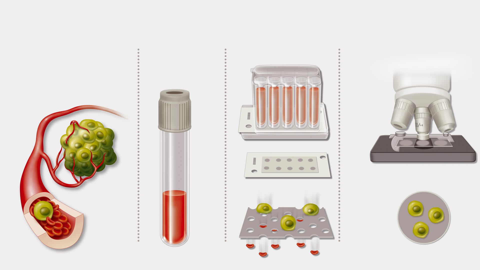 How a cancer blood test works