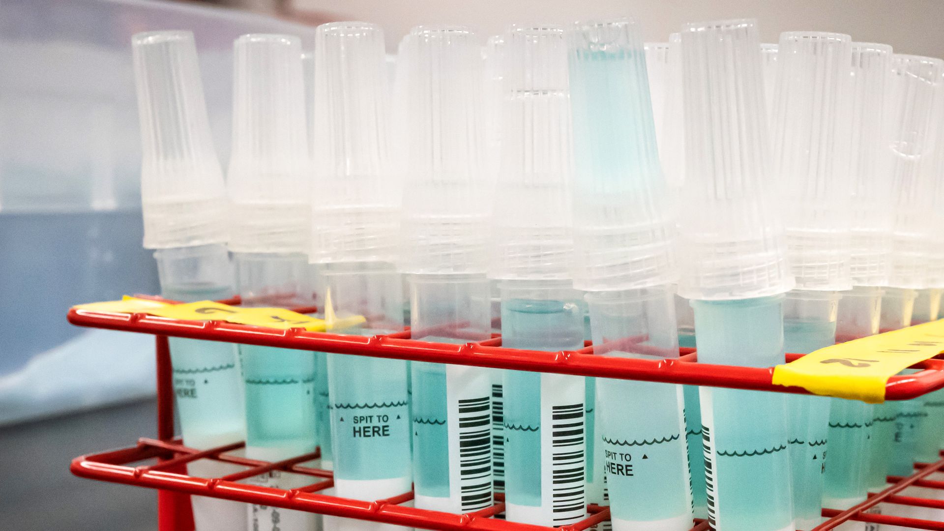 Saliva samples from COVID tests.