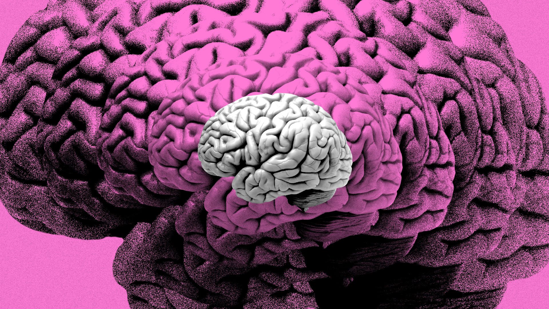Illustration of copies of a human brain gradually becoming more distorted.