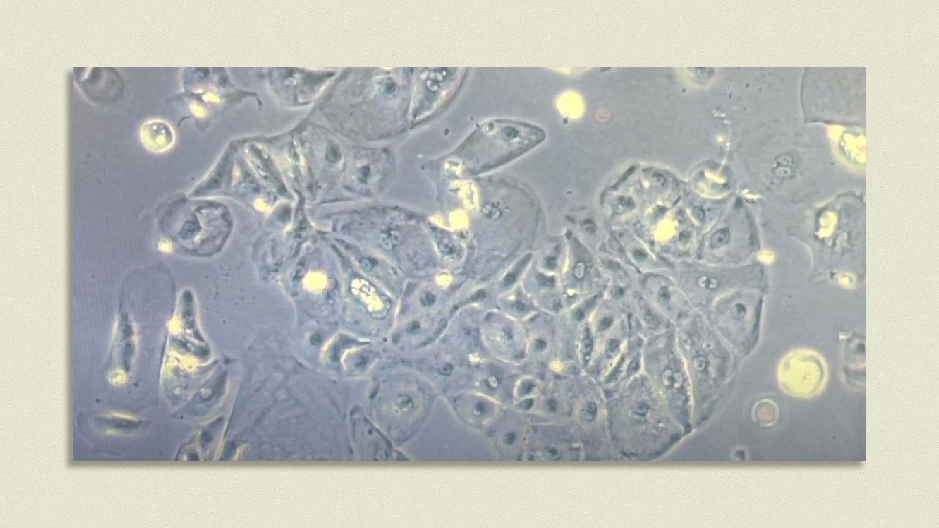  Cardiomyocytes derived from healthy human induced pluripotent stem cells. The cells were allowed to beat spontaneously and were video imaged under bright field microscopy. Credit: Alison Schroer, Soah Lee, Daniel Bernstein, Sean M. Wu, Stanford University