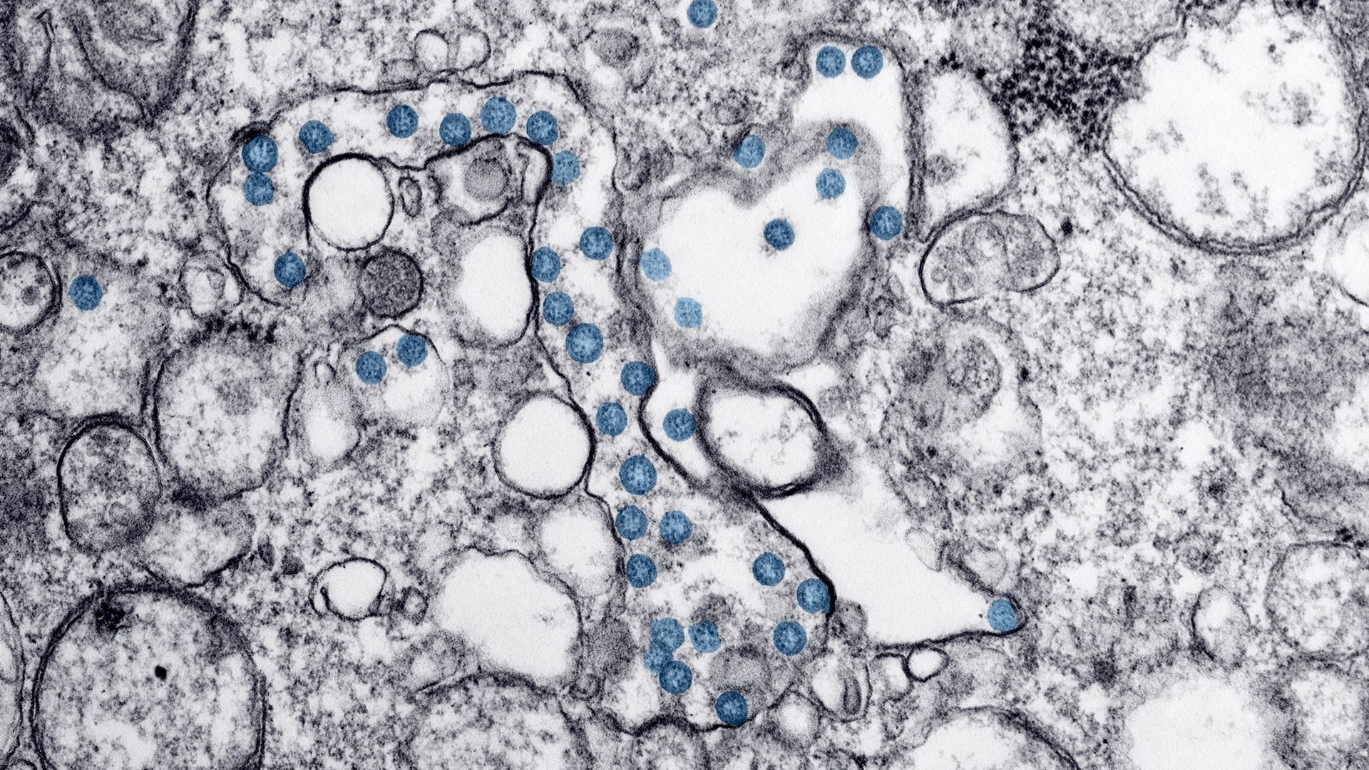 Transmission electron microscopic image of an isolate from the first US case of COVID-19