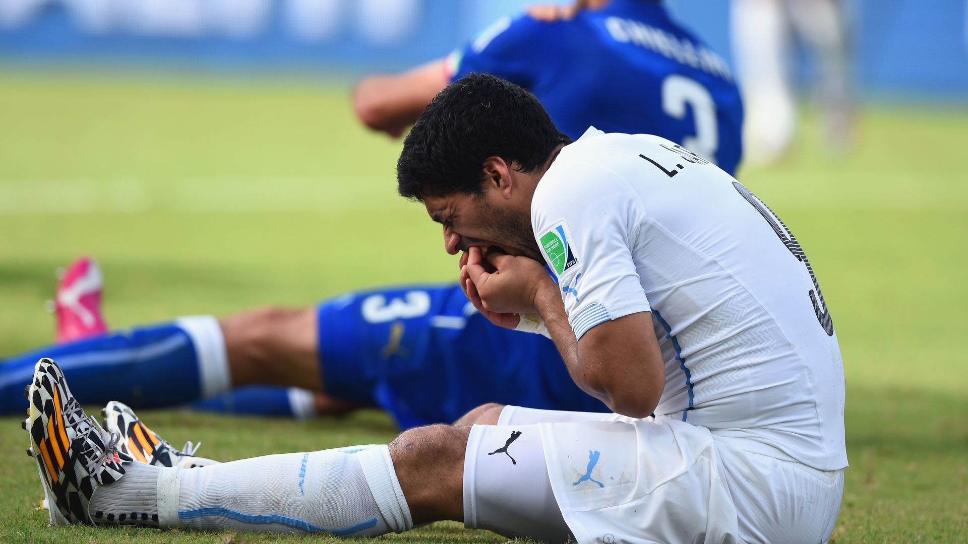 Suarez holding his teeth
