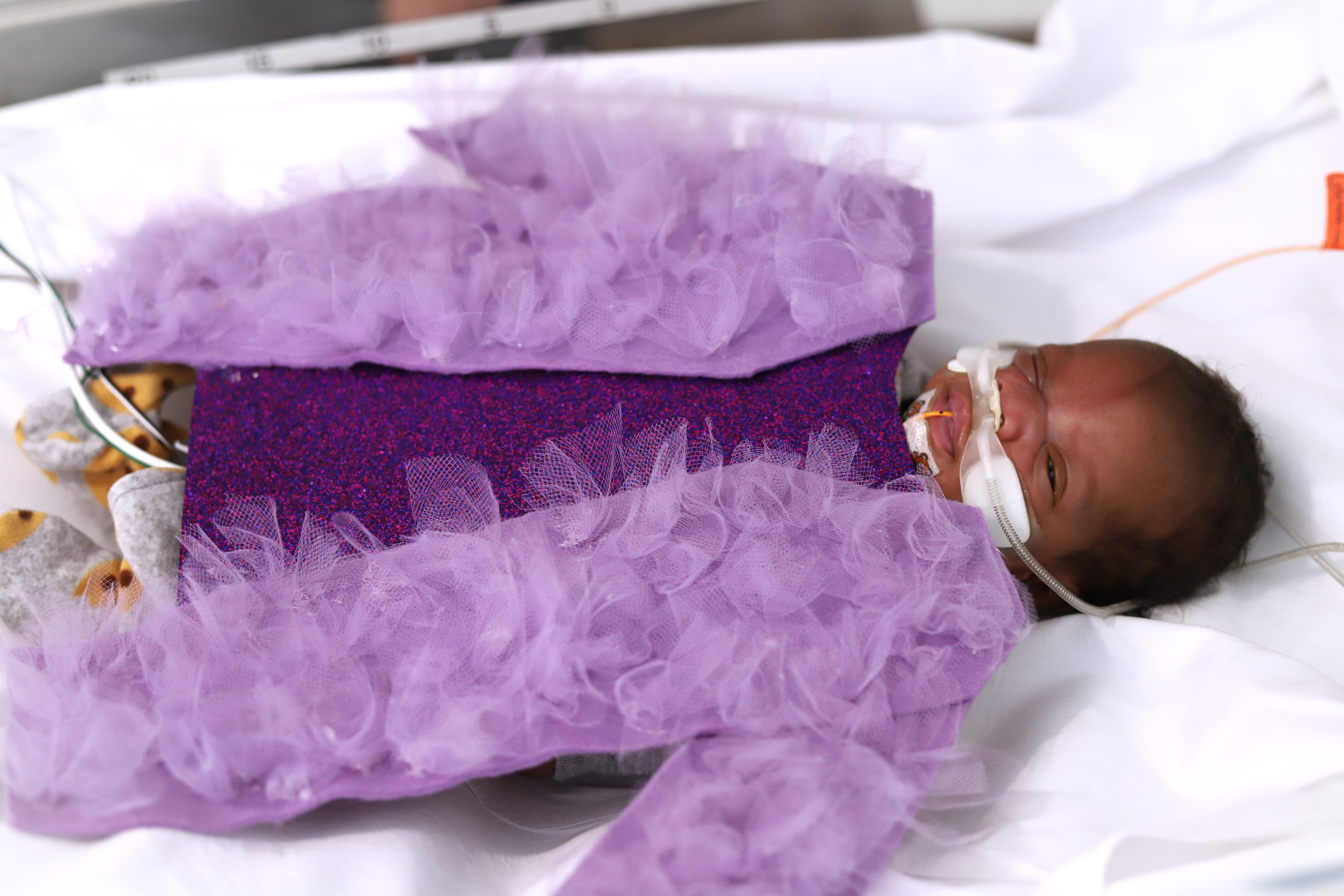 Photo shows a baby in a purple ruffle costume.