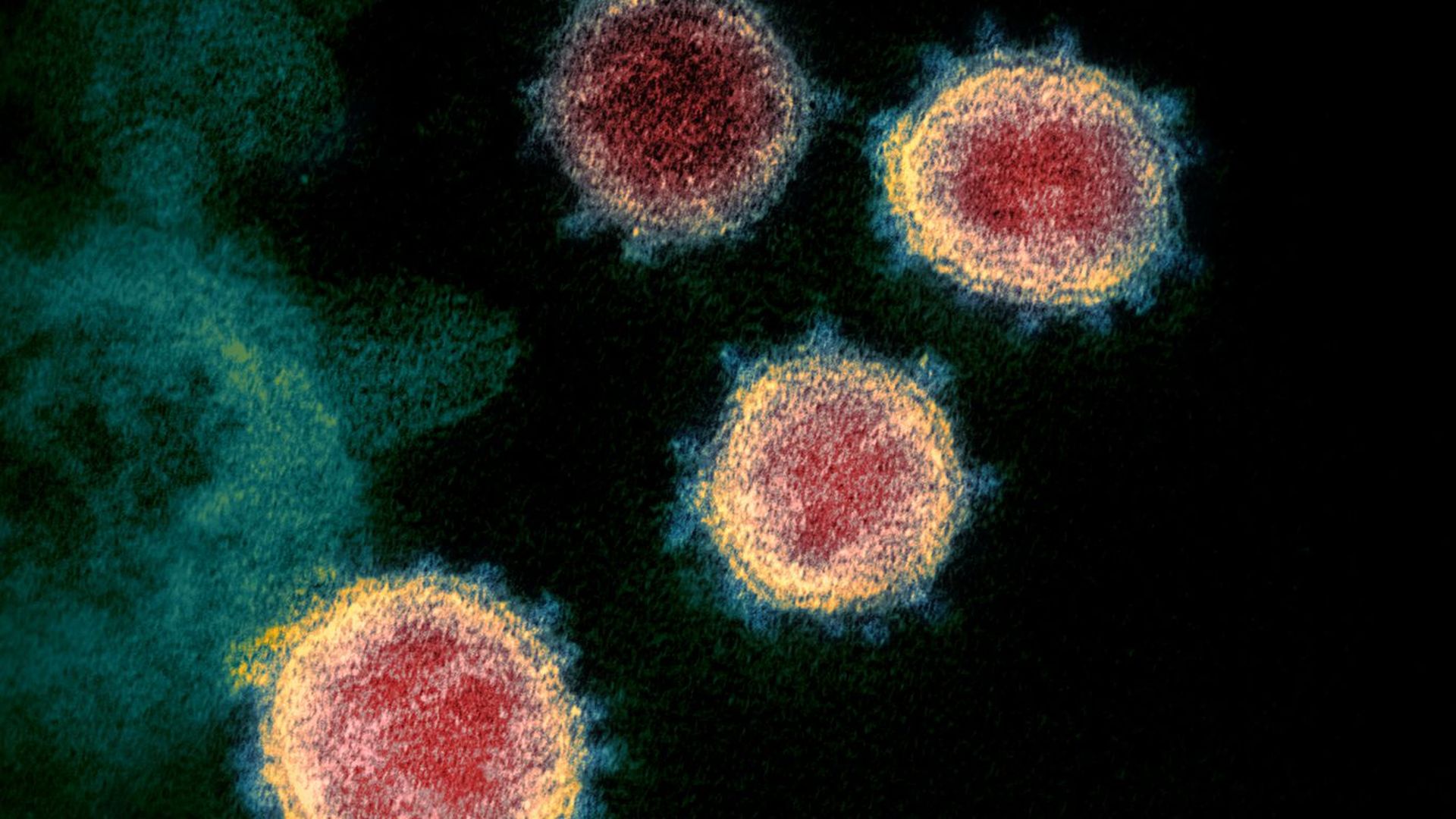 COVID-19. Photo: Image Point Fr - LPN/BSIP/Universal Images Group via Getty Images