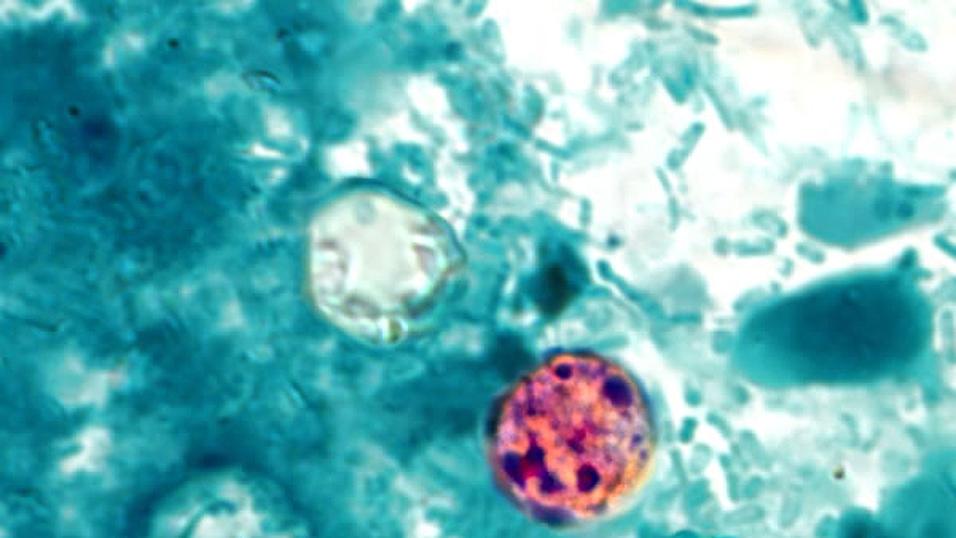 Microscopic image of four Cyclospora 