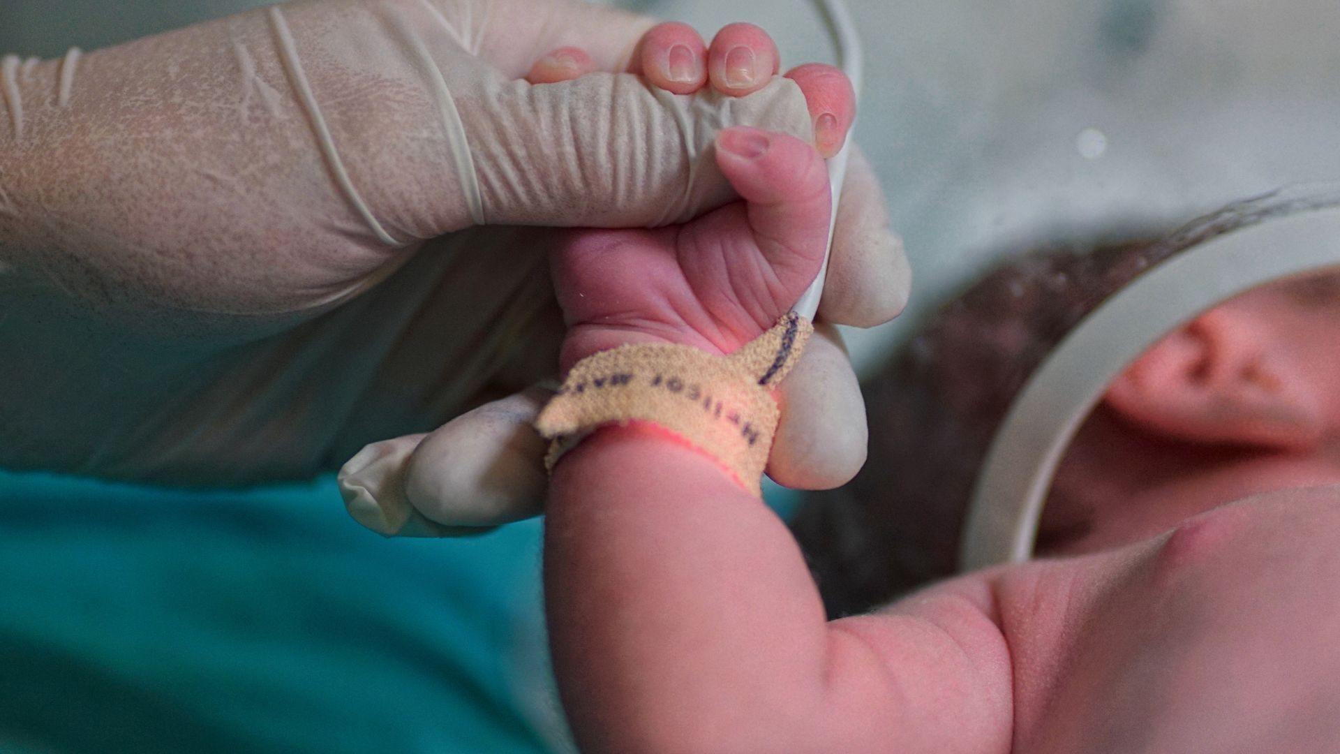 Photo of a newborn baby.