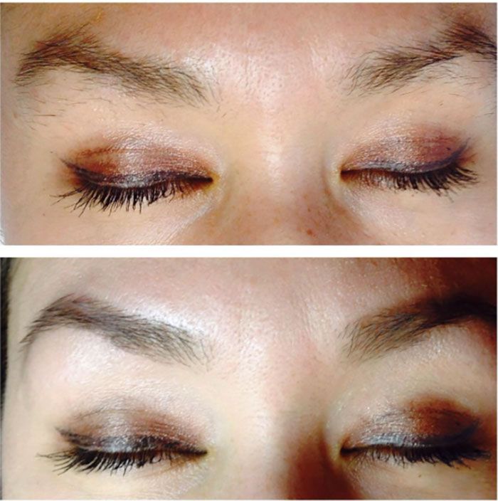 brow sugaring