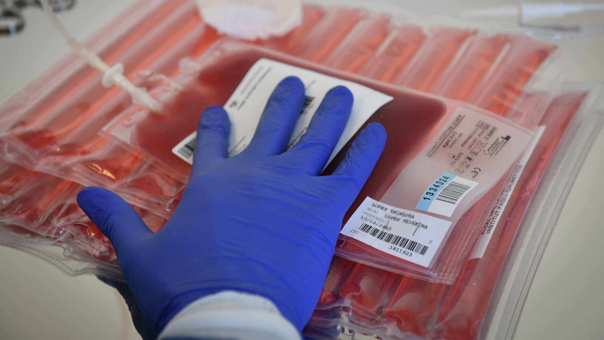 A lab technician prepares to thawing blood bag before genetically modifying a patients immune cells 
