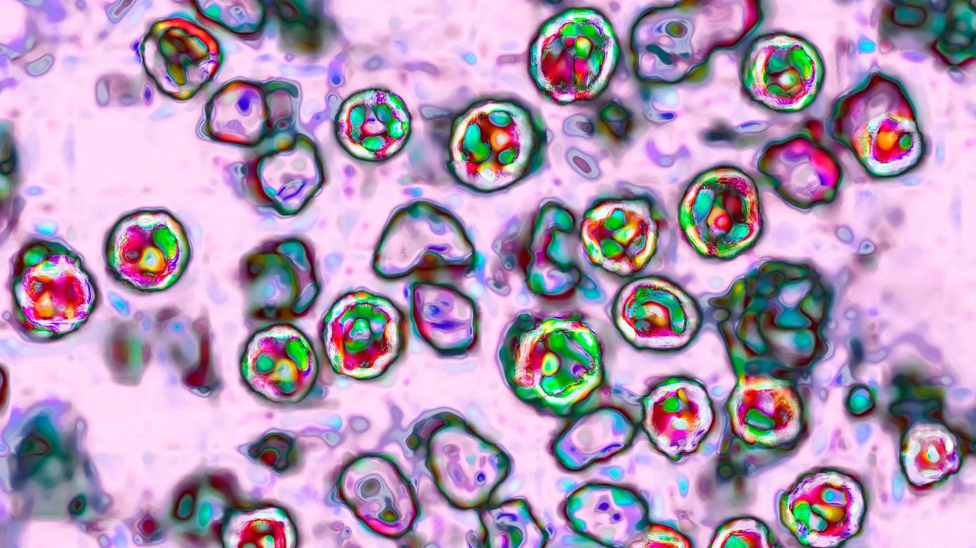 Indiana records first measles case of 2025 amid nationwide outbreak