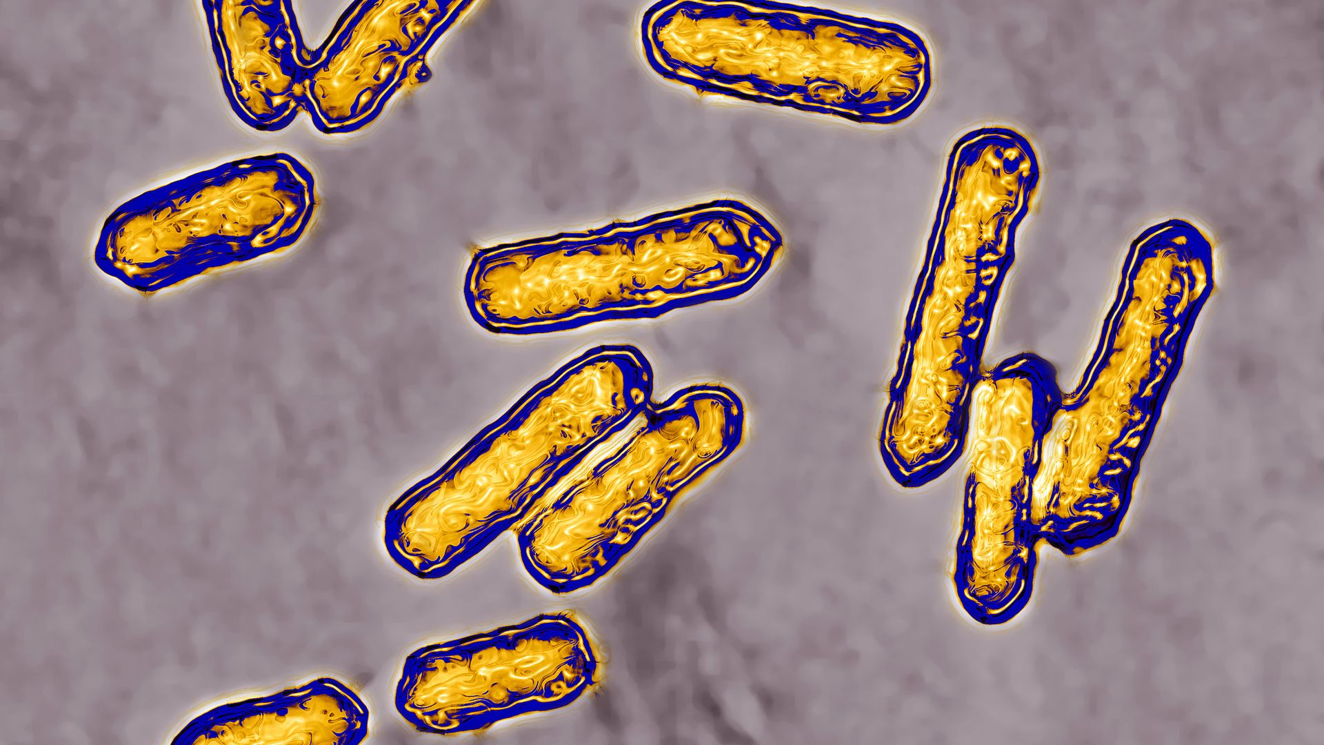 A photo of Listeria.