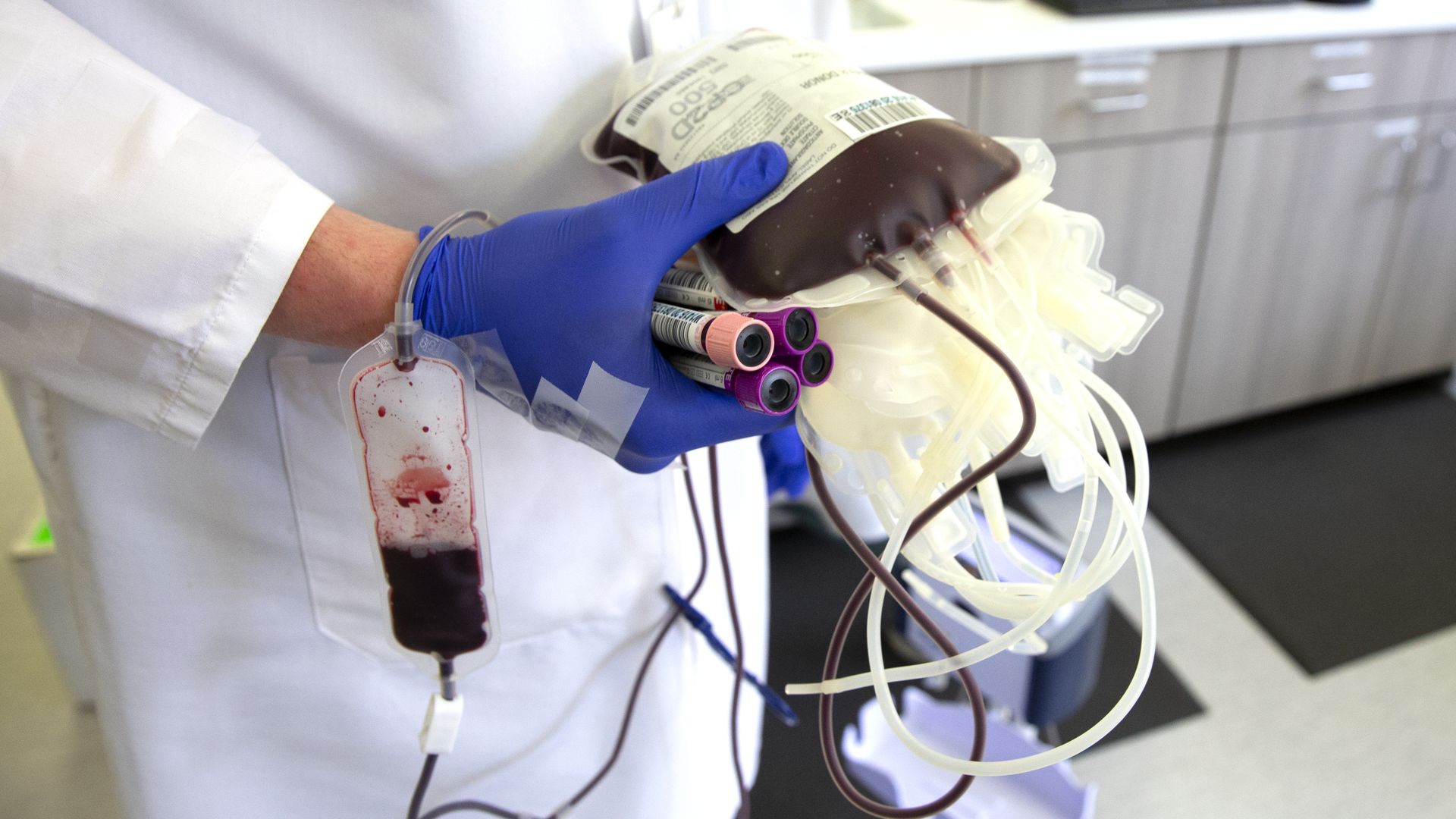 In this image, a gloved hand holds a bag of blood 