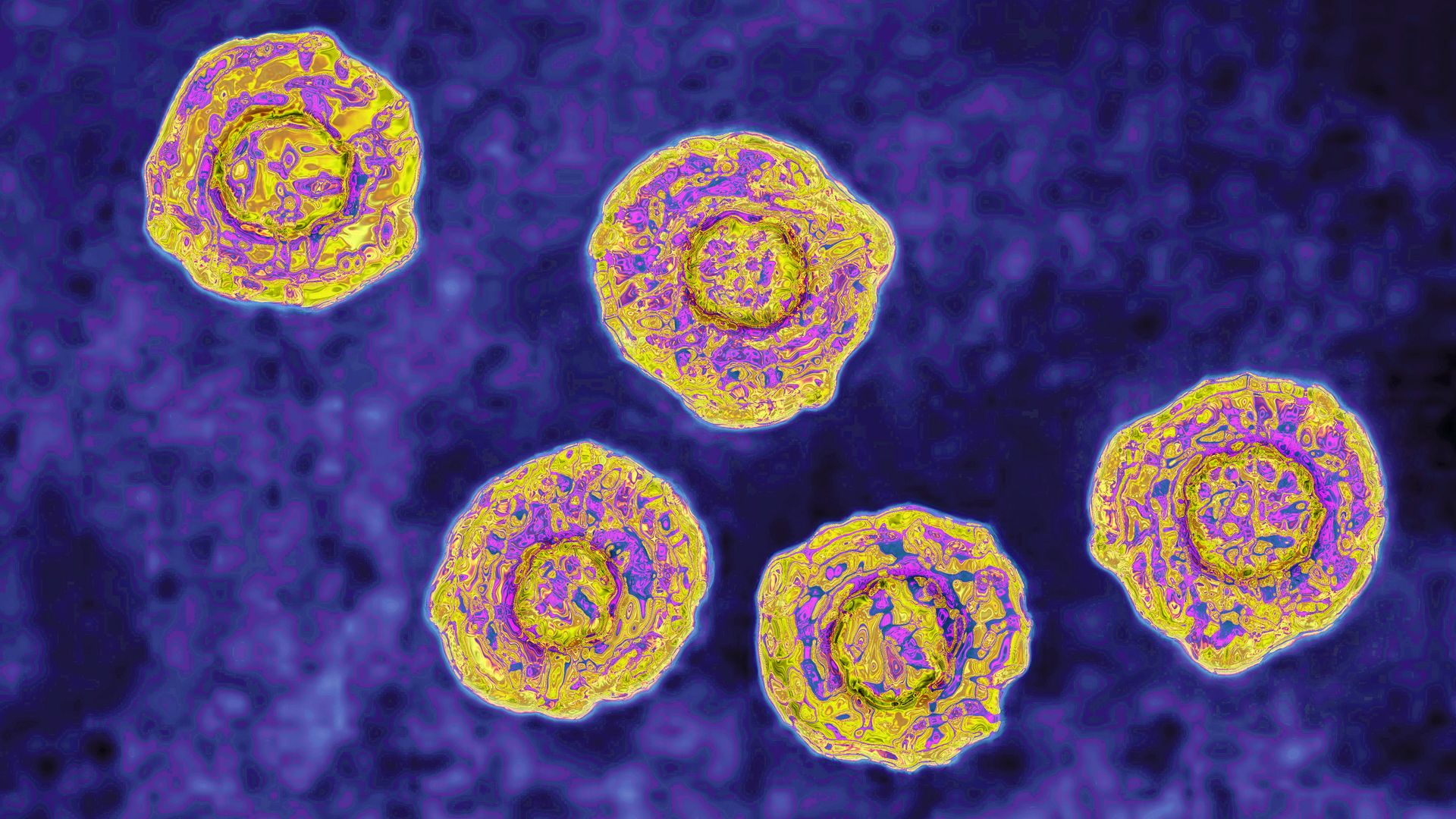 Hepatitis C virus