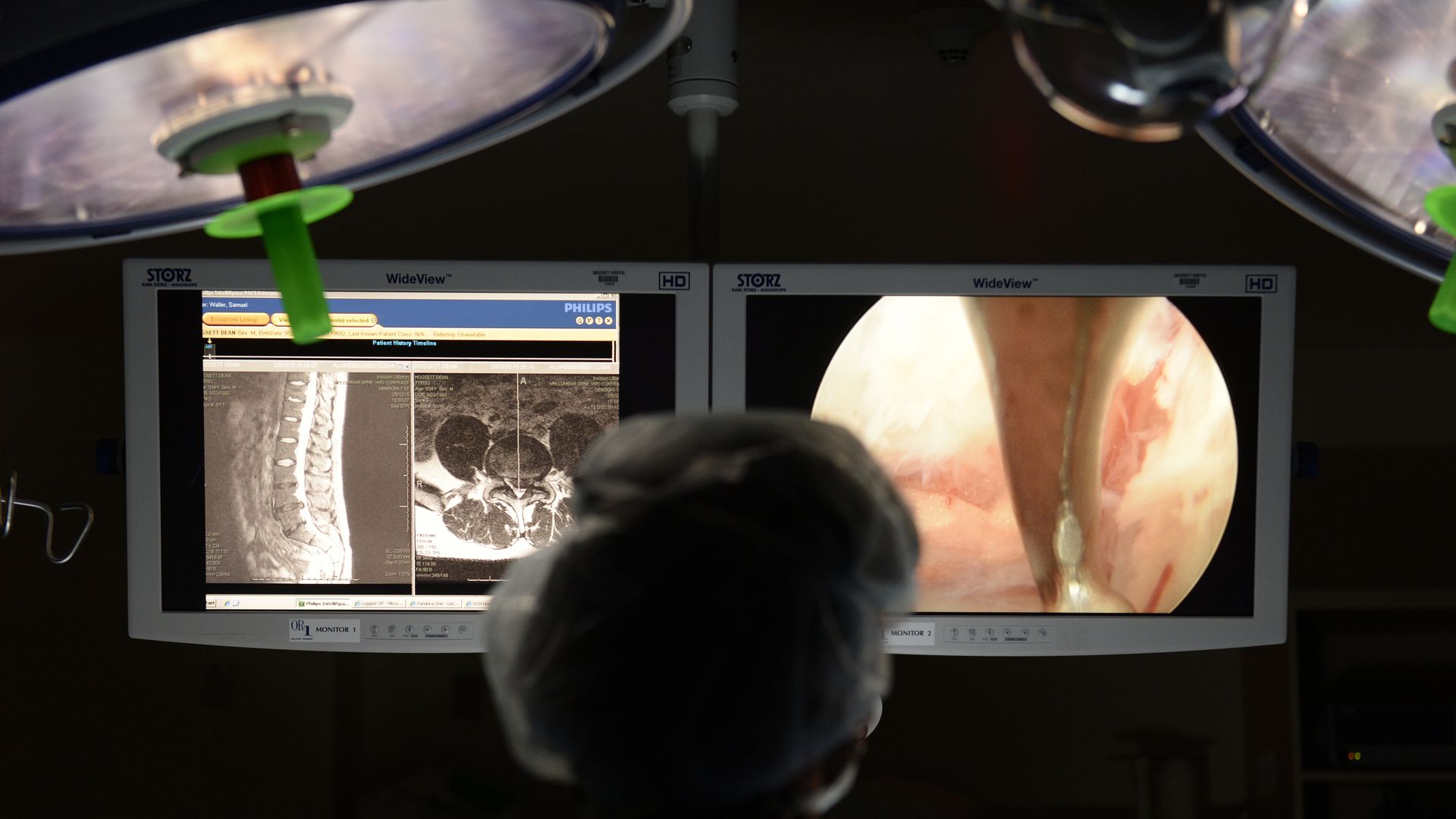 A doctor looks at monitors during a surgery.