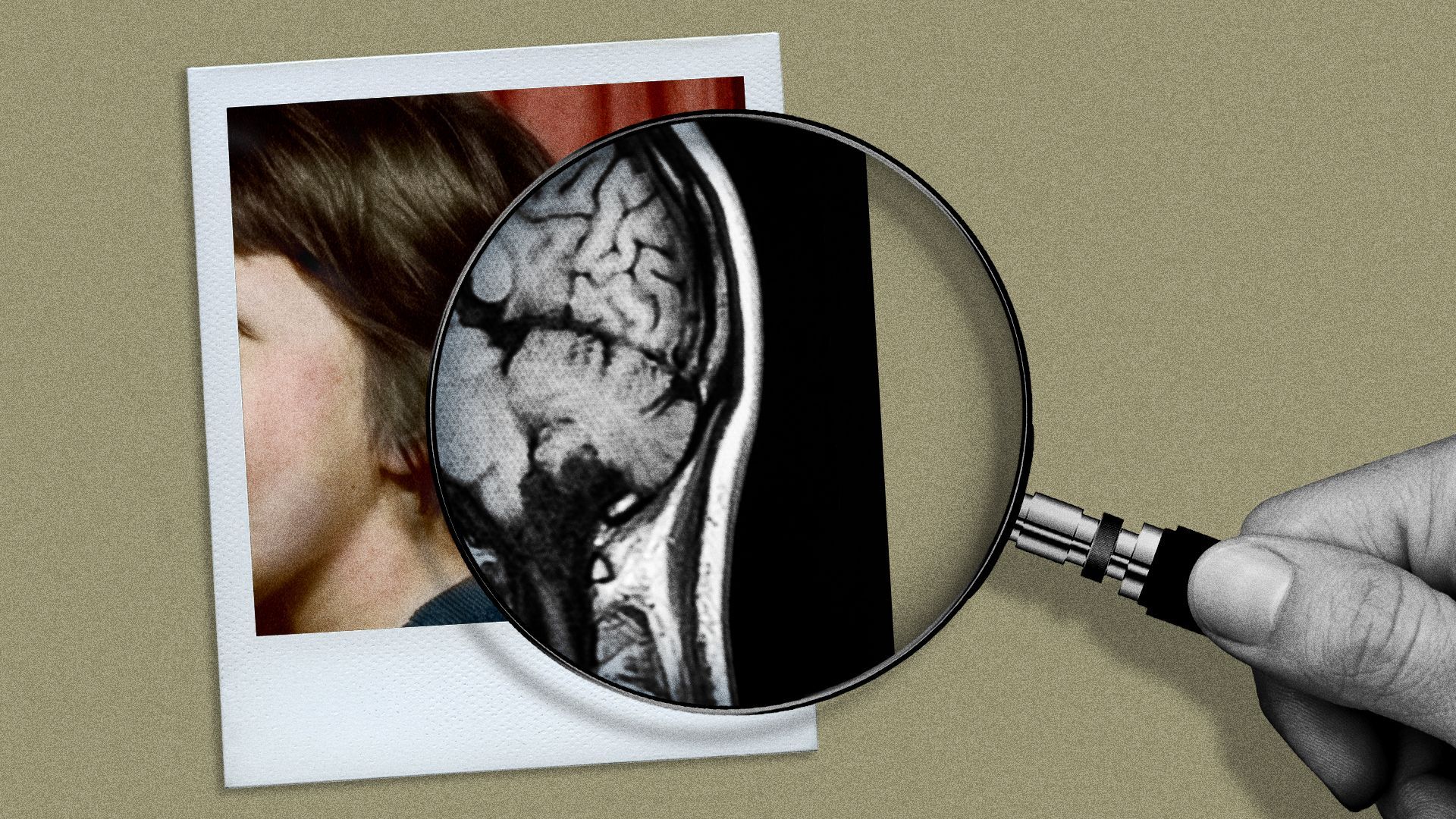 Illustration of a magnifying glass hovering over a polaroid picture but revealing a brain scan. 