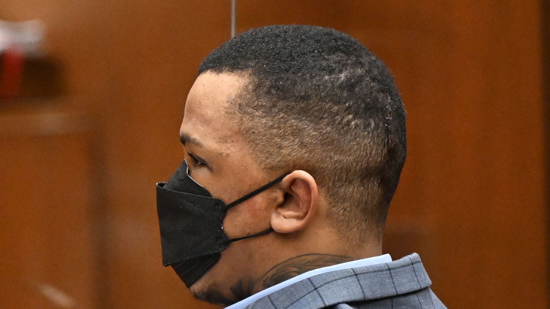 Stitches can be seen on the back of Eric Holder's head.