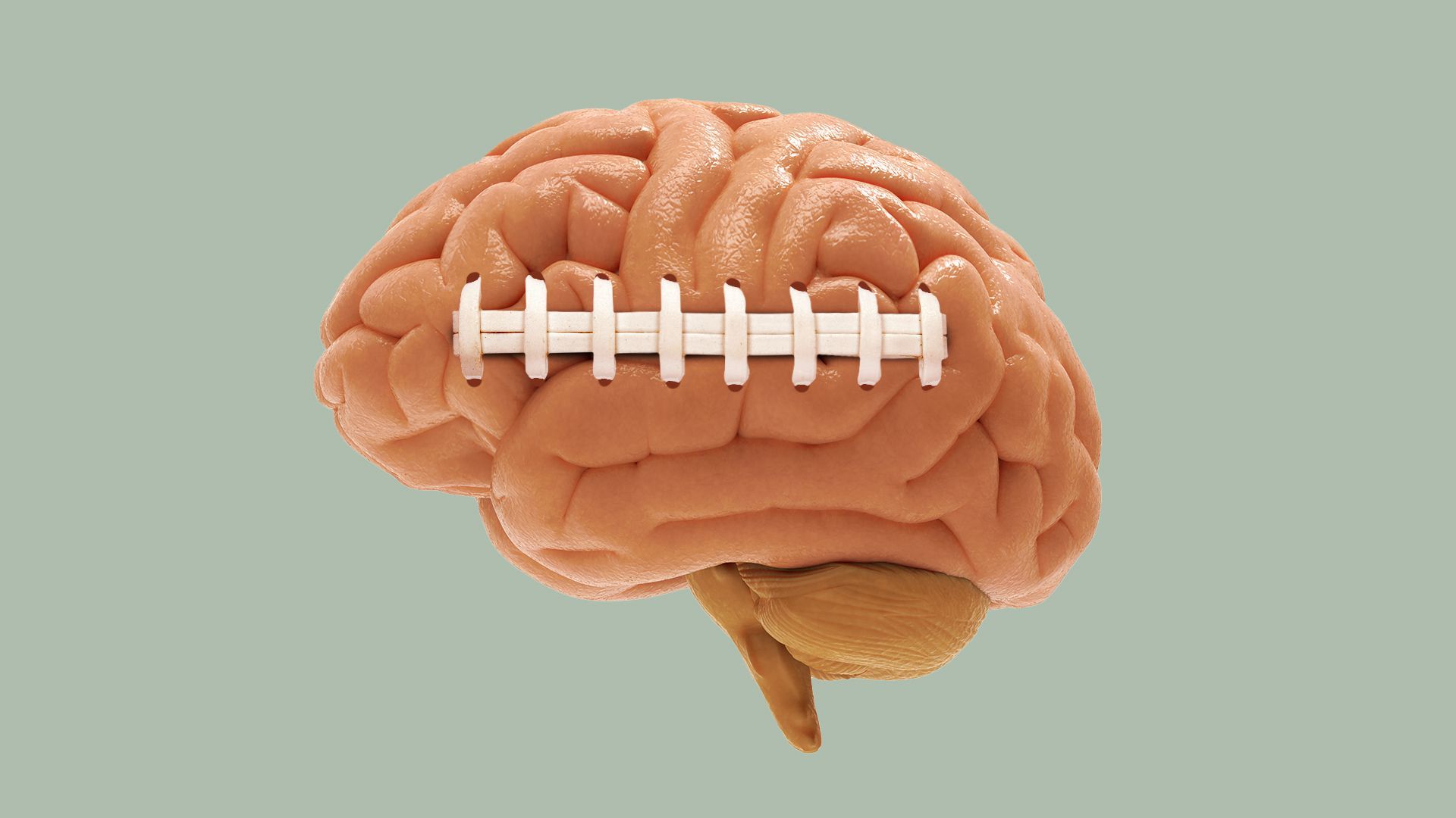 Illustration of a brain with football stitching across the side. 