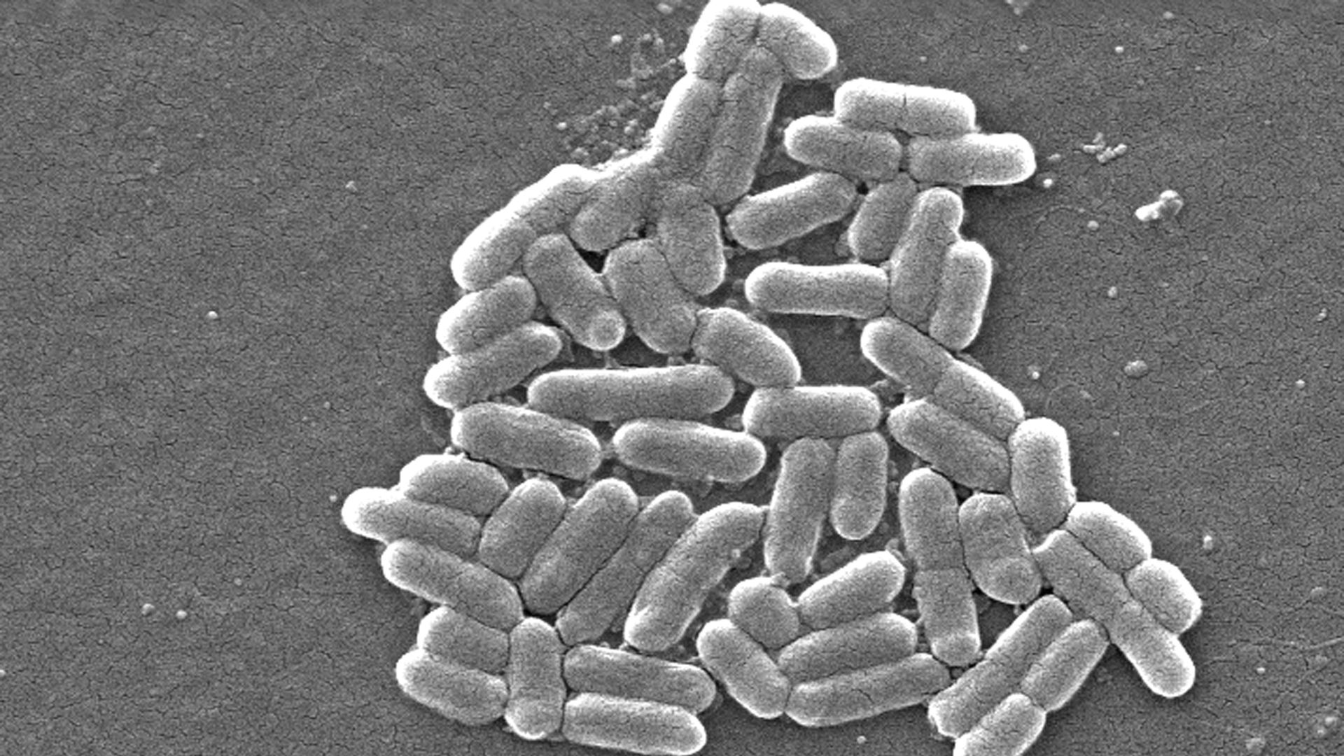 A photo of the bacteria shigella under a microscope