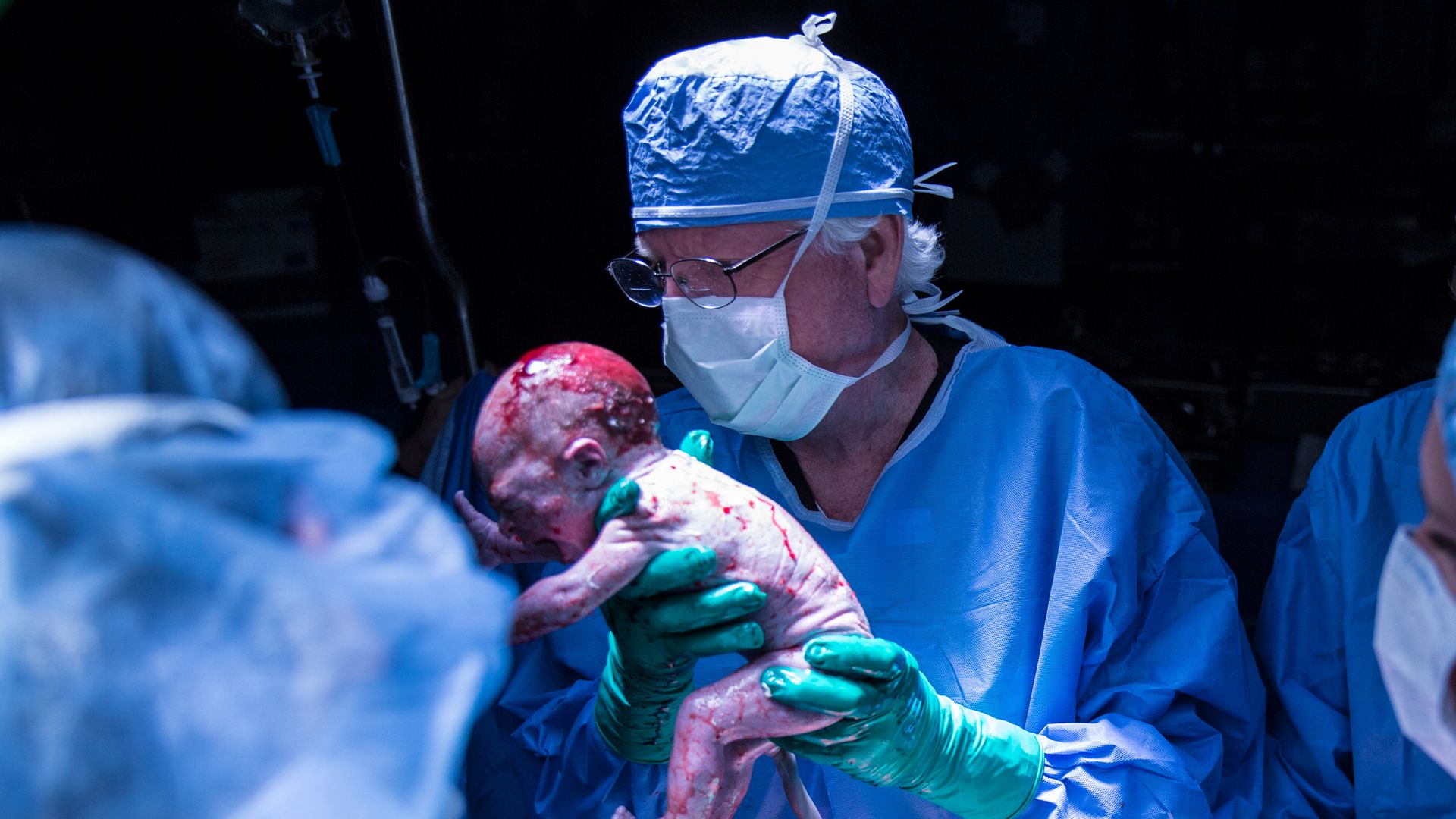 The delivery of a baby born to a woman who received a uterus transplant at Baylor University Medical Center.