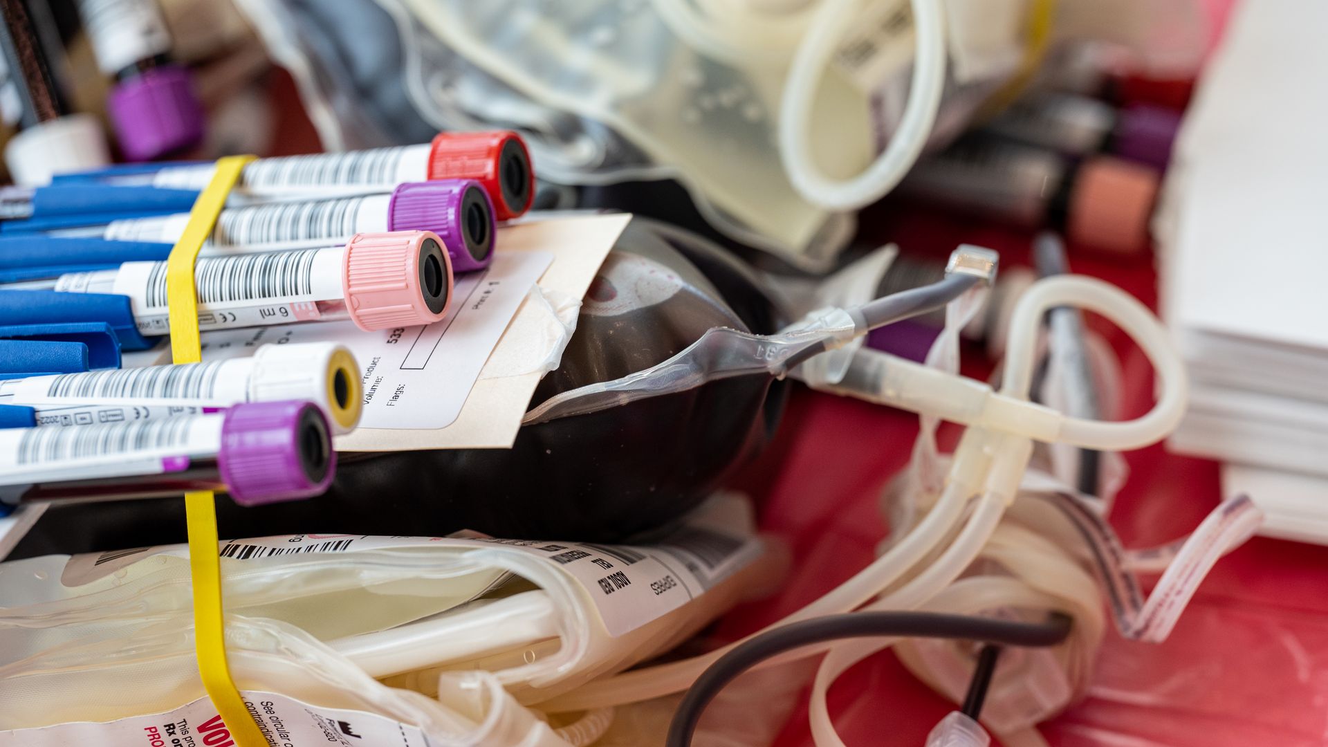 Photo of a bag of blood with labeled tubes sitting on top of it
