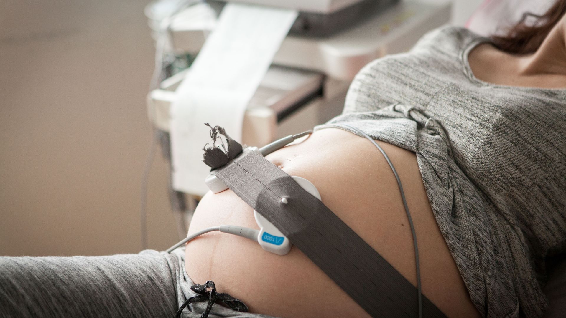 Photo of pregnant woman undergoing sonogram