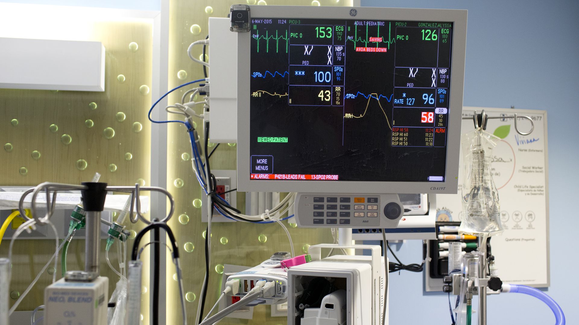 A computer monitor in a hospital room showing vitals signs.