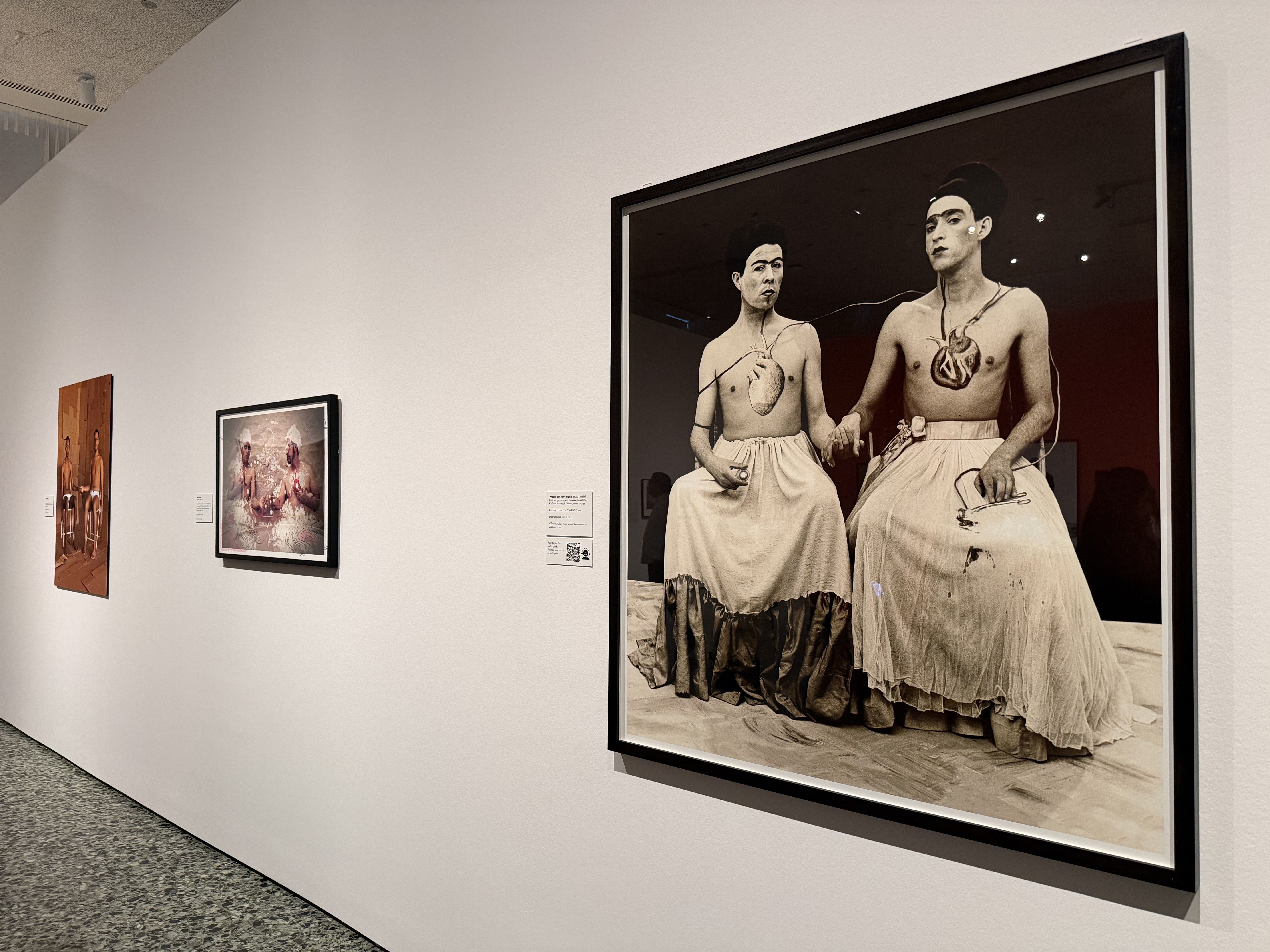 Gallery wall with three artworks; largest is a sepia photo of two shirtless figures in long skirts, holding hands and connected by cords to anatomical hearts on their chests.