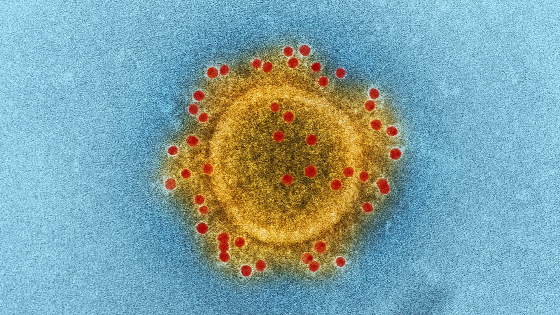MERs is in the same family as the novel coronavirus which began to infect patients in Wuhan, China