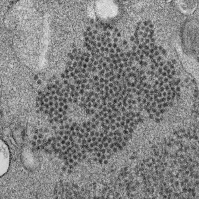 Photo of Enterovirus D-68, a suspect in causing AFM 
