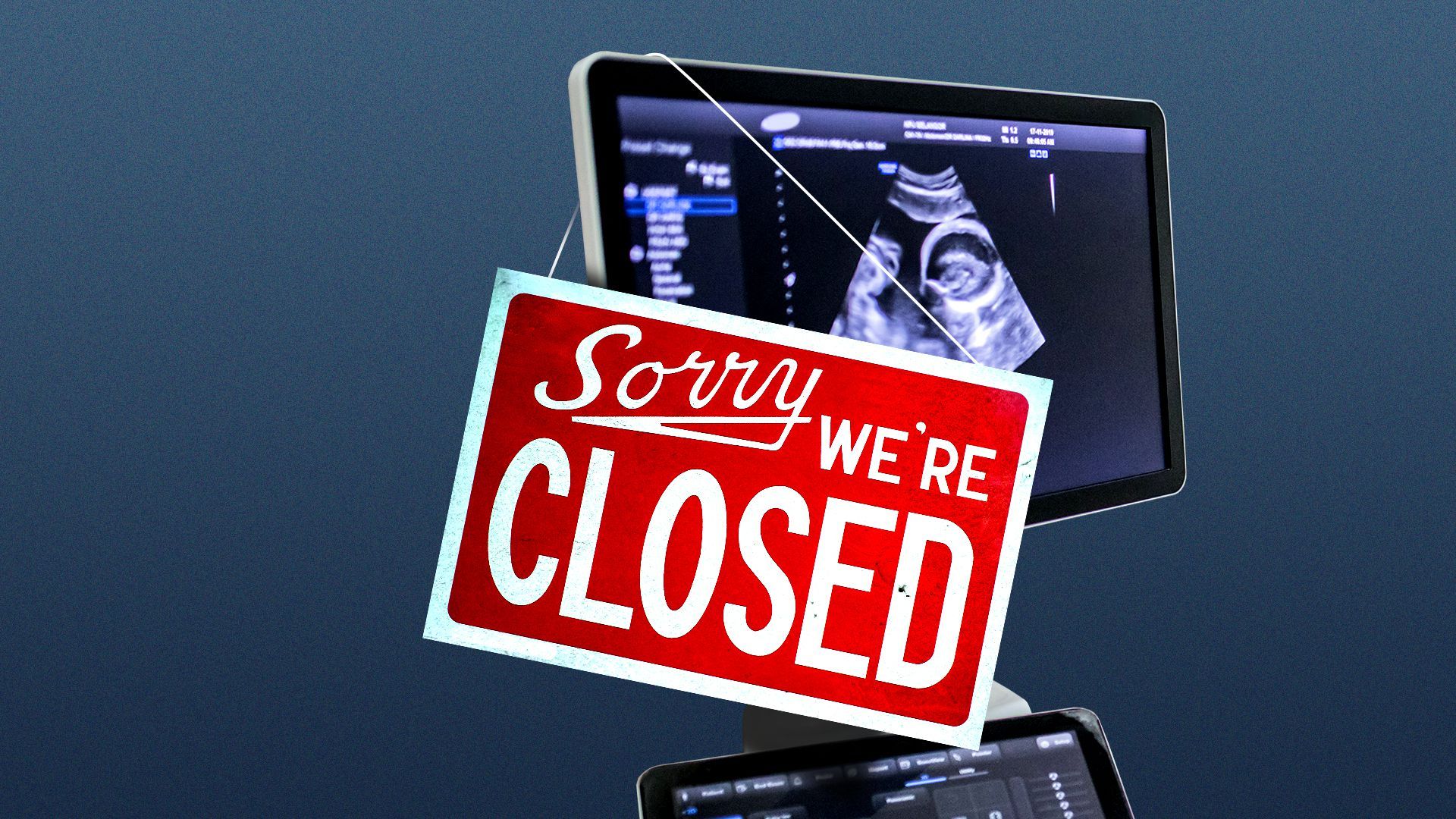 Illustration of a sign saying "SORRY WE'RE CLOSED" hanging from a sonogram monitor