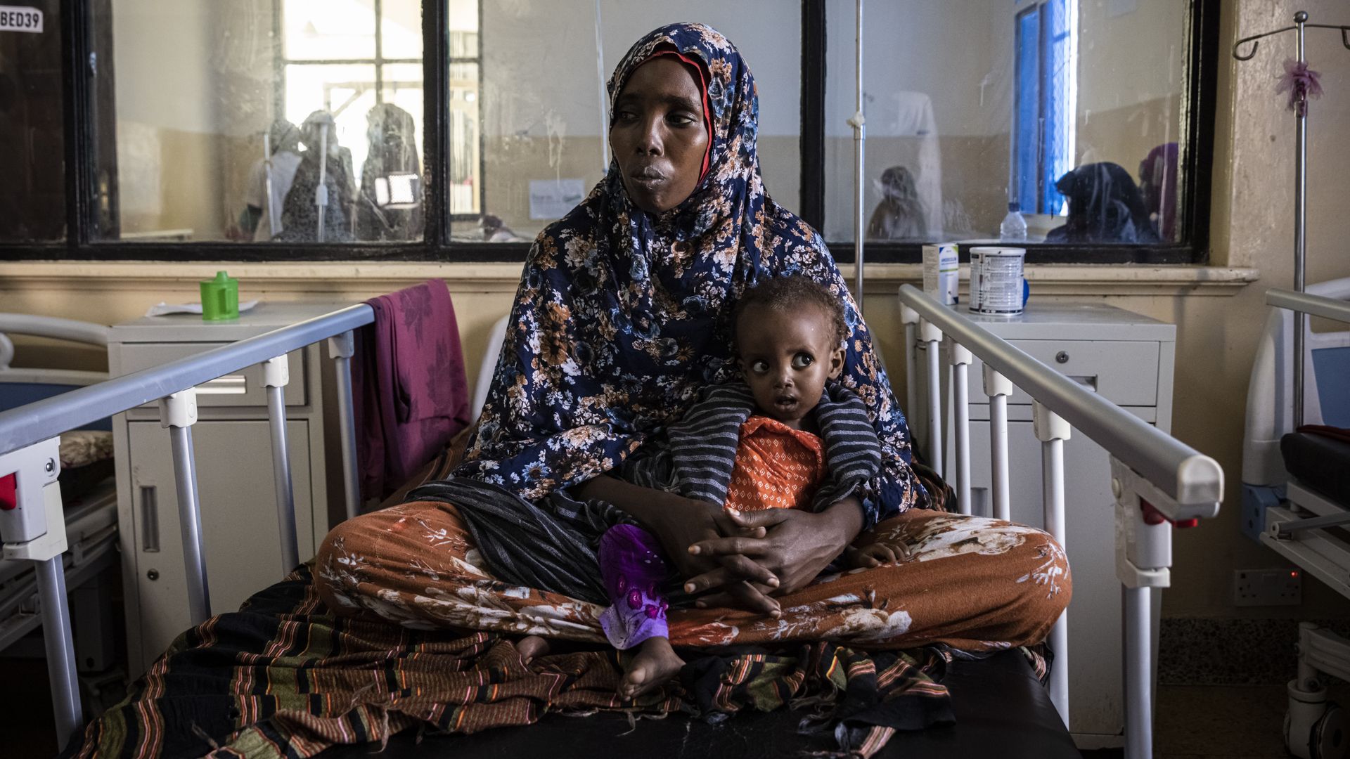 A baby lies with its mother while being treated for severe acute malnutrition in Mogadishu, Somalia on Sept. 4