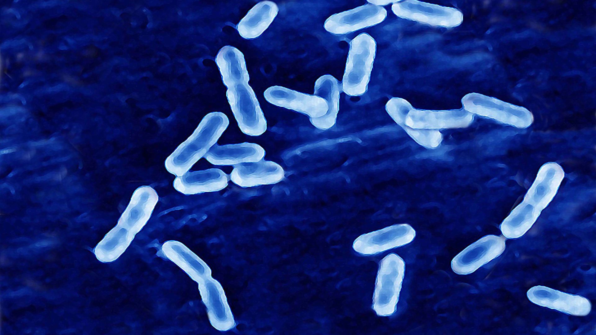 Listeria