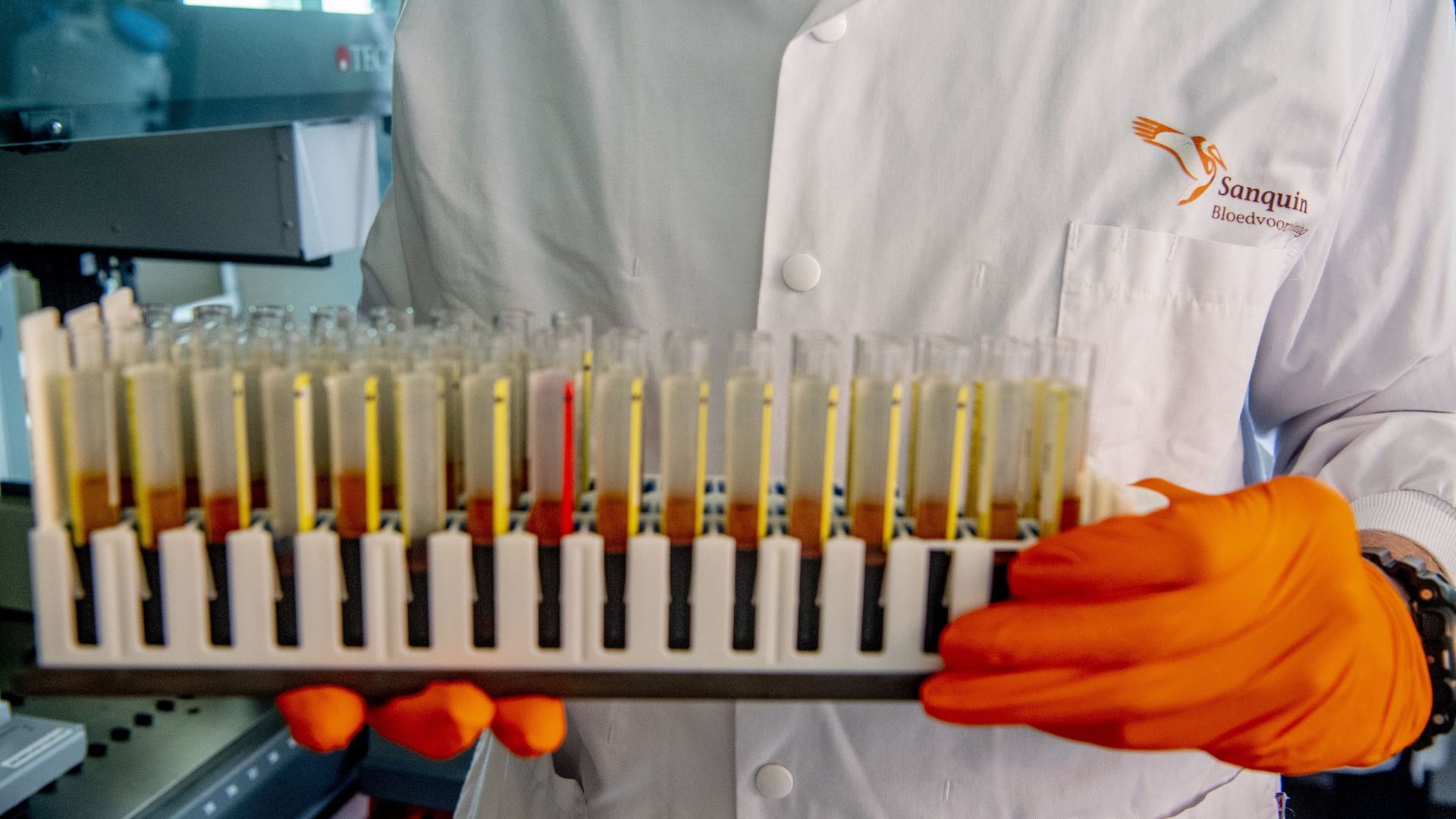  Test tubes with blood samples of donors that have developed antibodies against the coronavirus.