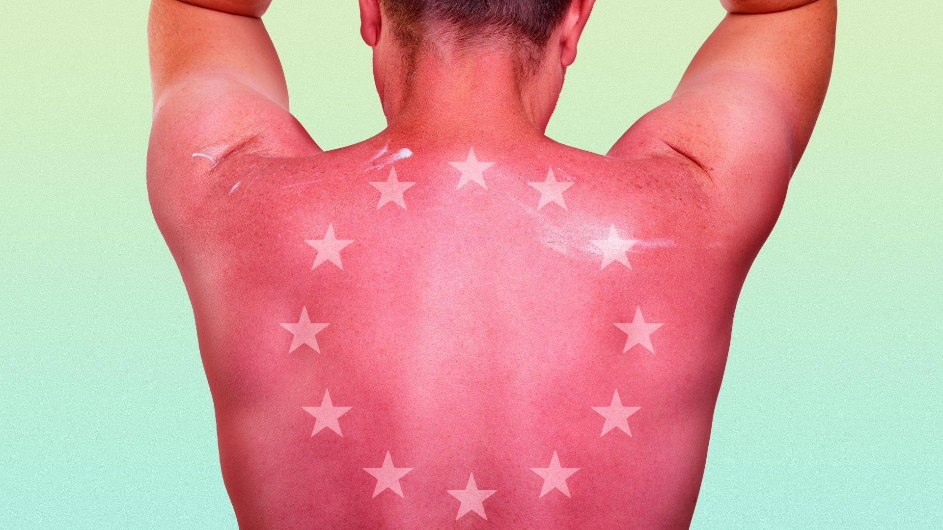 Illustration of a man with a sunburned back with lighter skin in the shape of the EU flag