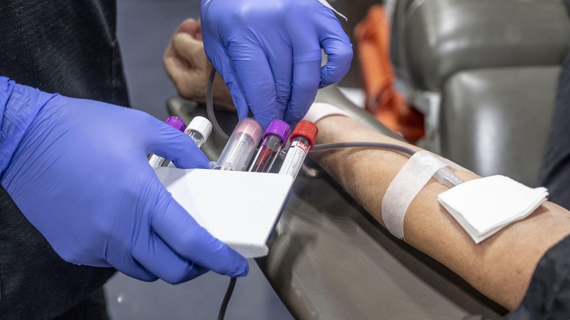 Picture of the arm of a person donating blood