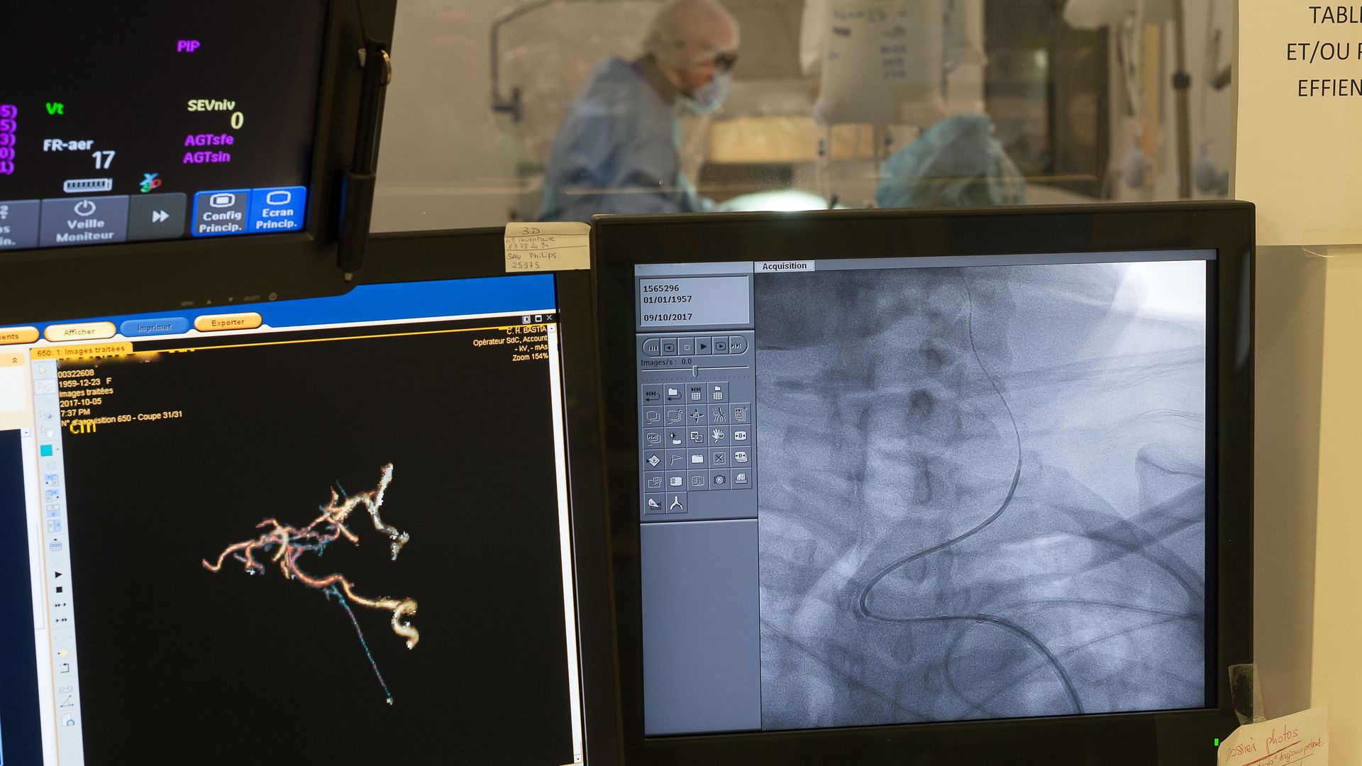 Computers show the inner workings of a blood clot