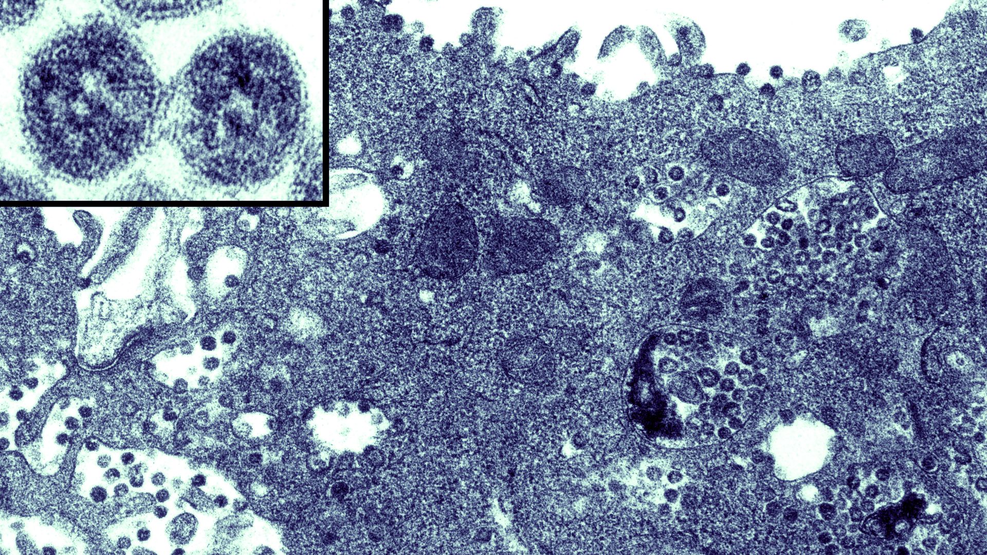 Coronavirus Contained Within The Endoplasmatic Reticulum Of A Vero E6 Cell. 