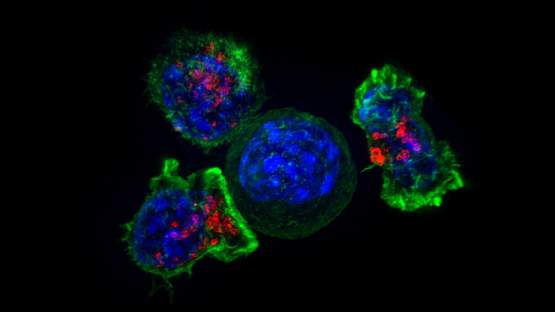 Killer T-cells surround a cancer cell