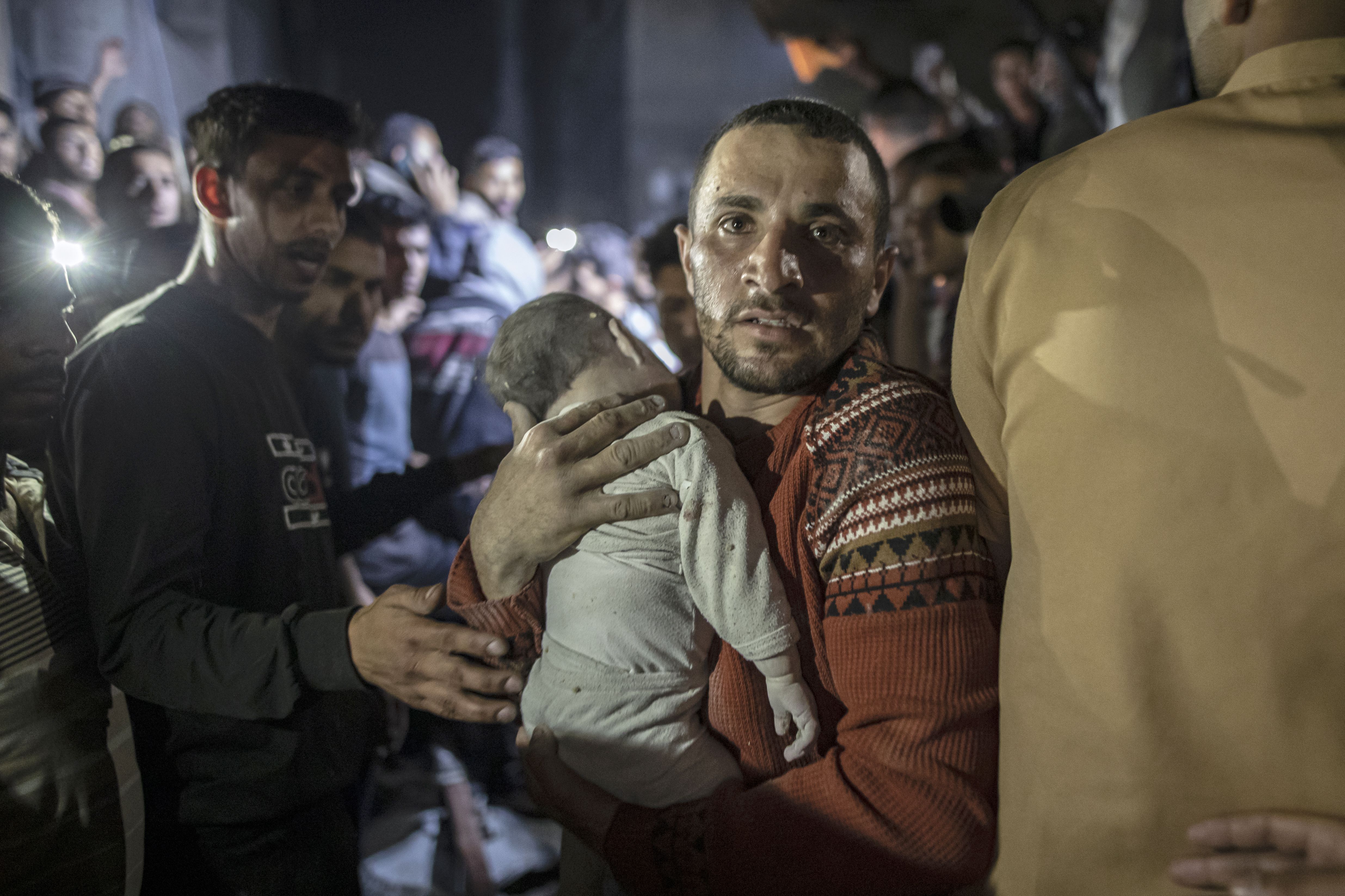 A man holds an injured baby as he pushes through a crowd. 