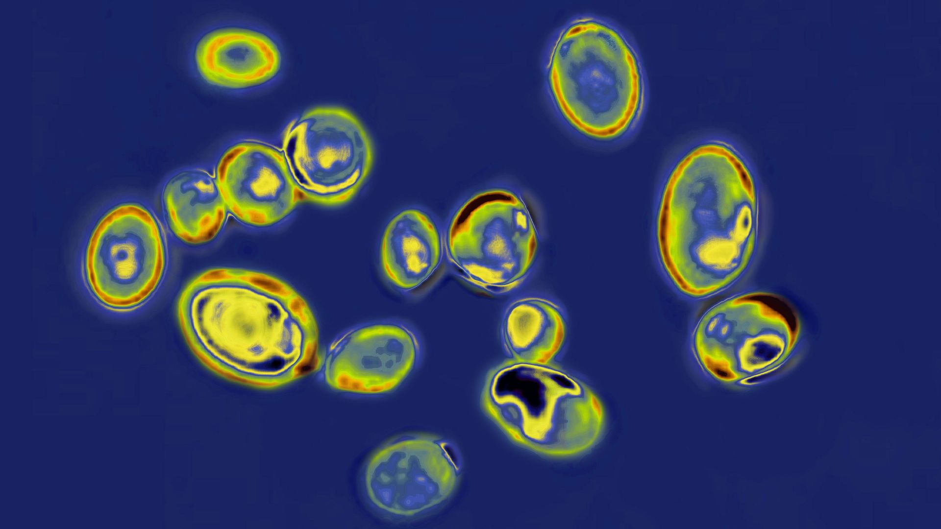 A closeup of fungus particles as viewed under a microscope.