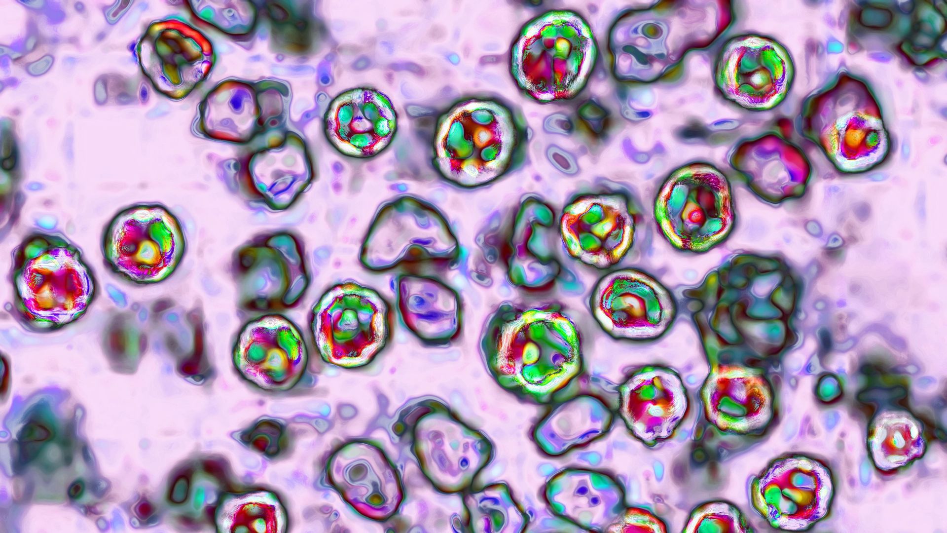 An image of measles viruses under a microscope.