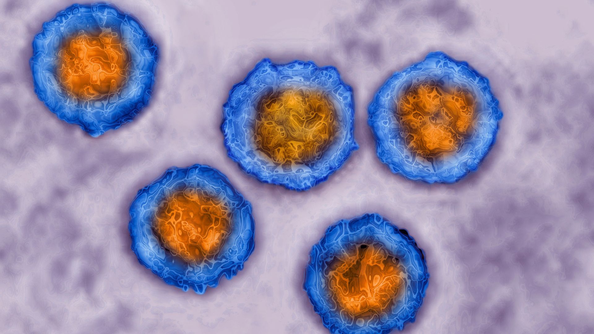 Human herpes virus taken with transmission electron microscopy. 