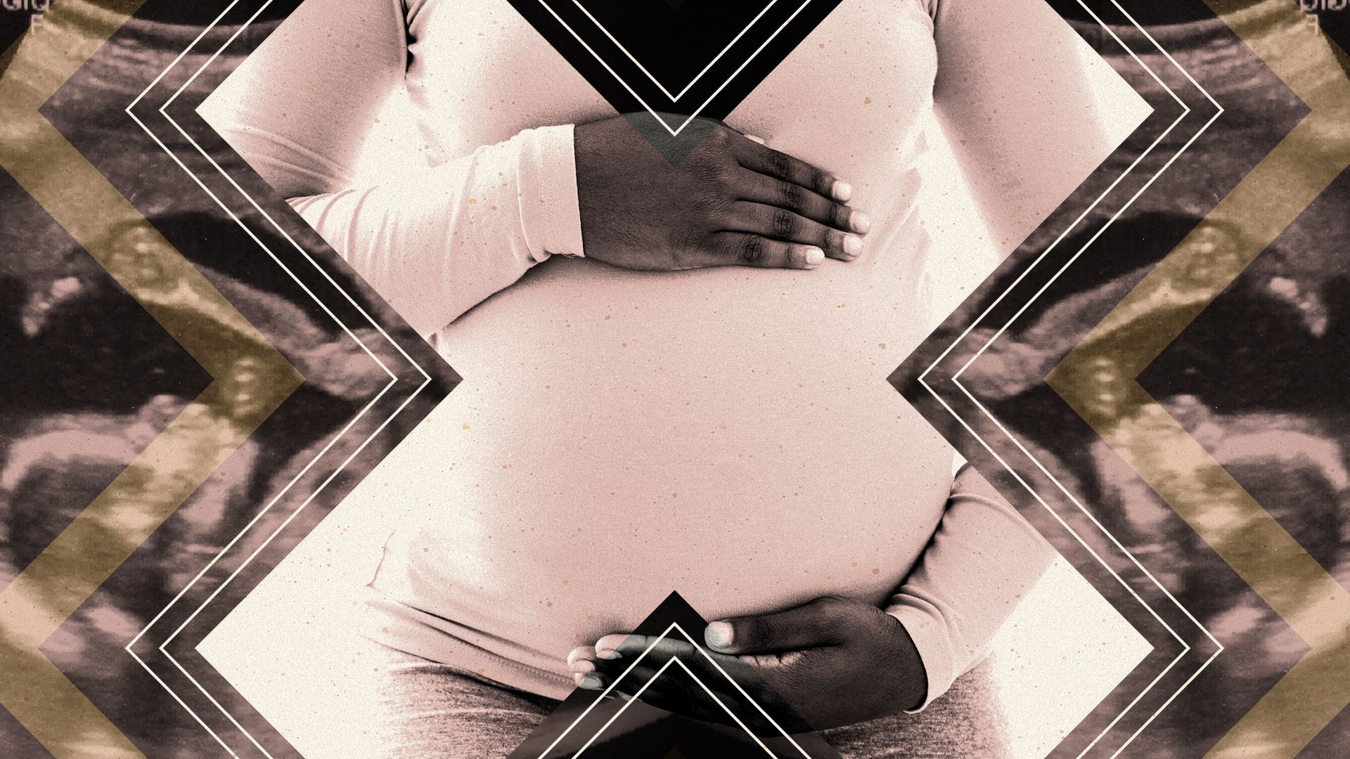 Illustration of geometric shapes containing a pregnant Black woman and ultrasounds.