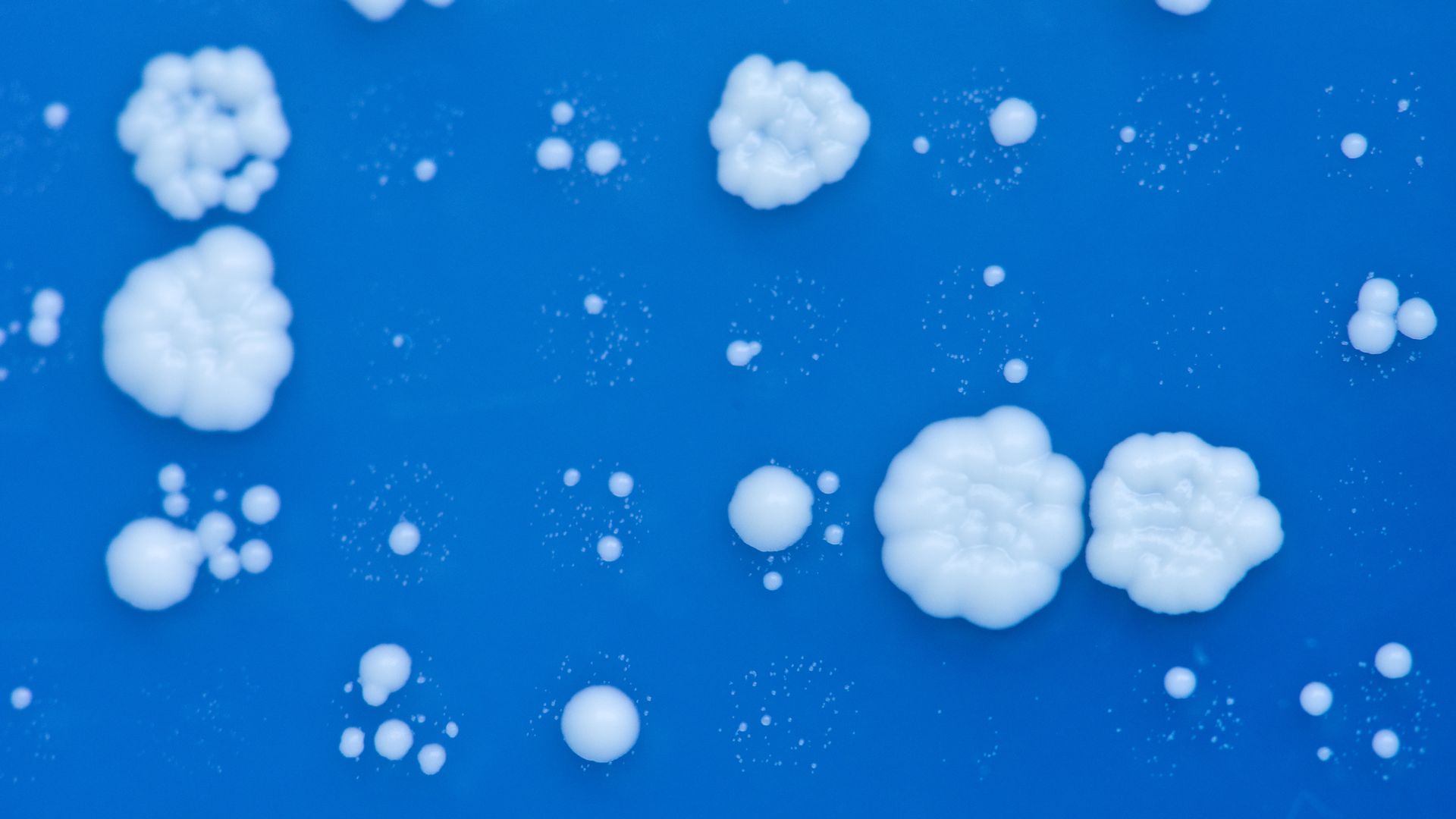 Photo of brewer's yeast cells on blue background