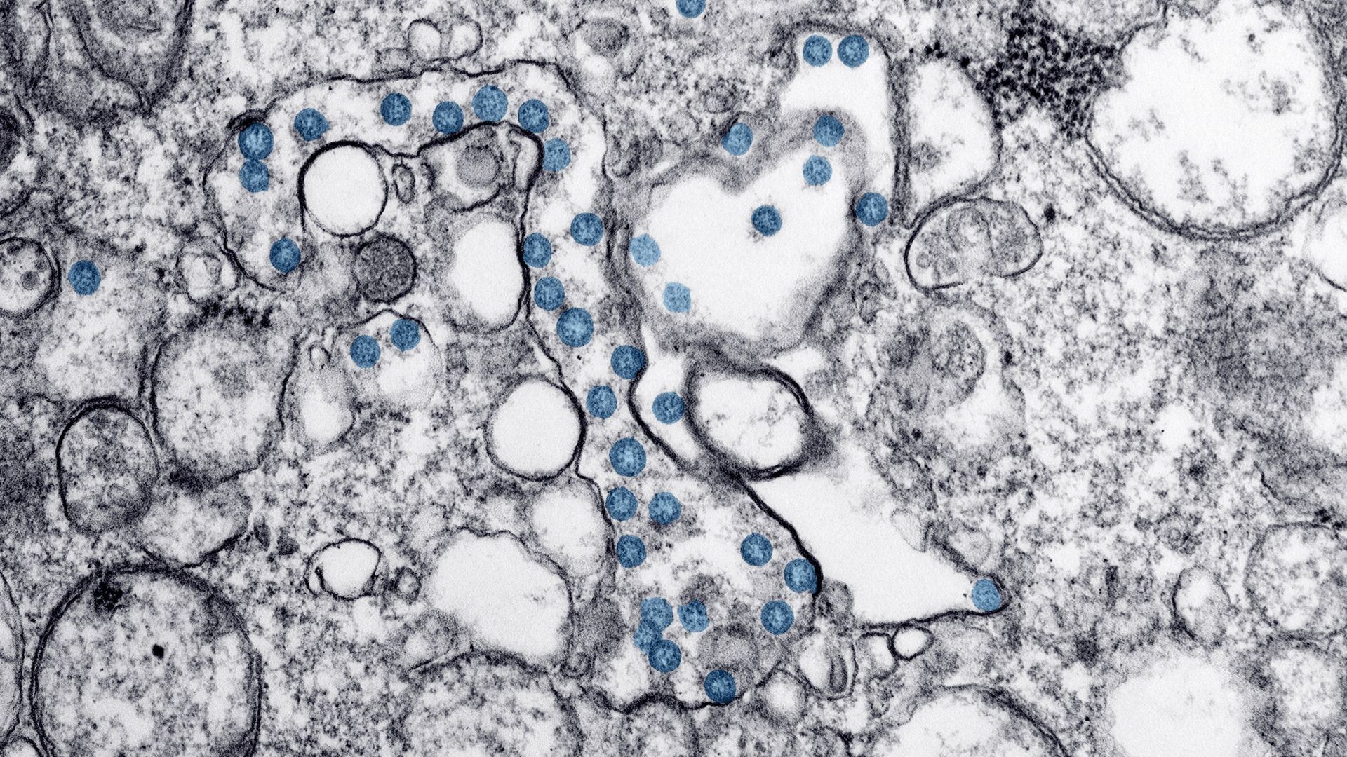 This image is a close up of the coronavirus