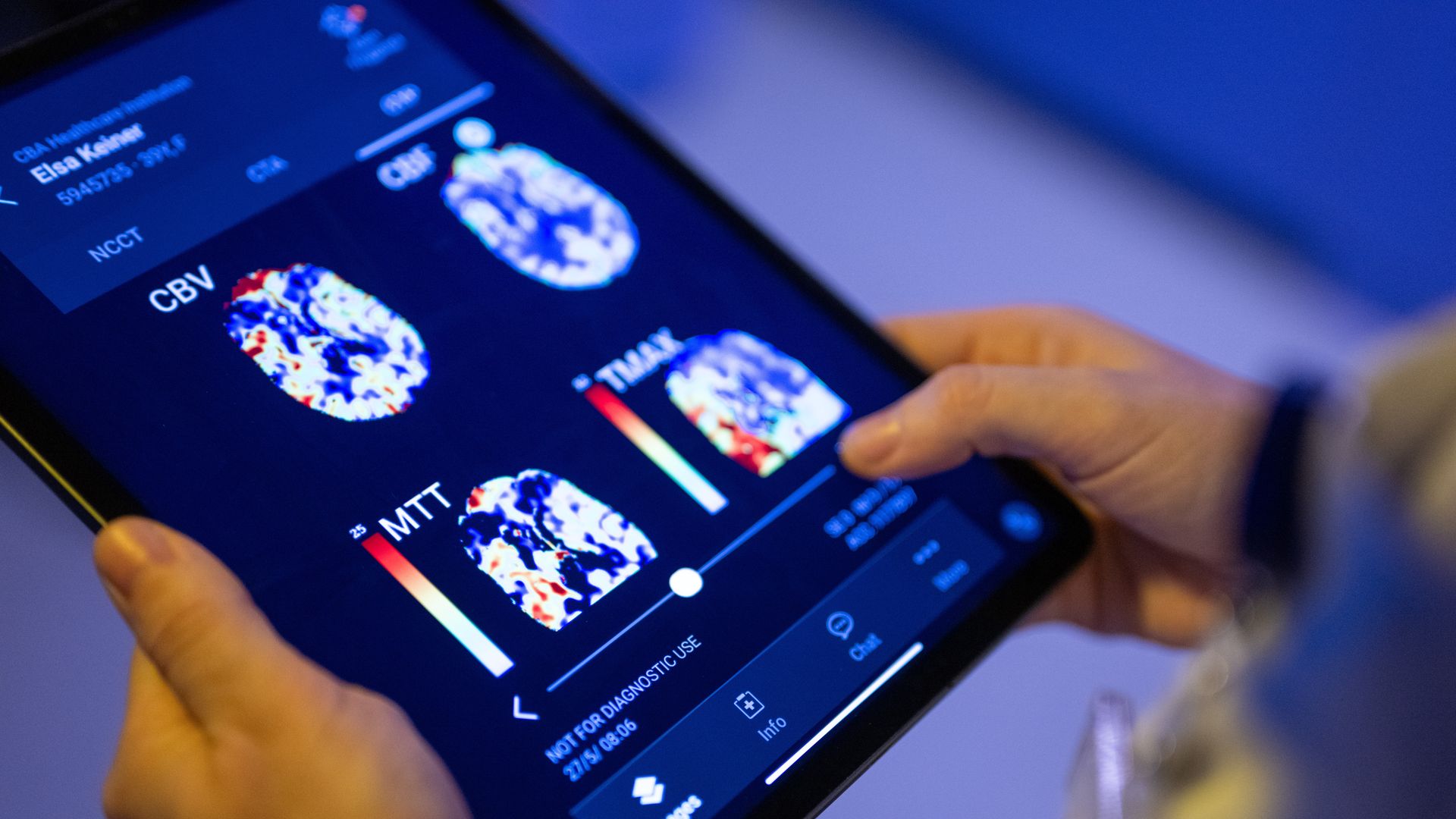 A radiologist at Unfallkrankenhaus Berlin looks at a patient's brain images in an AI-based app on a tablet