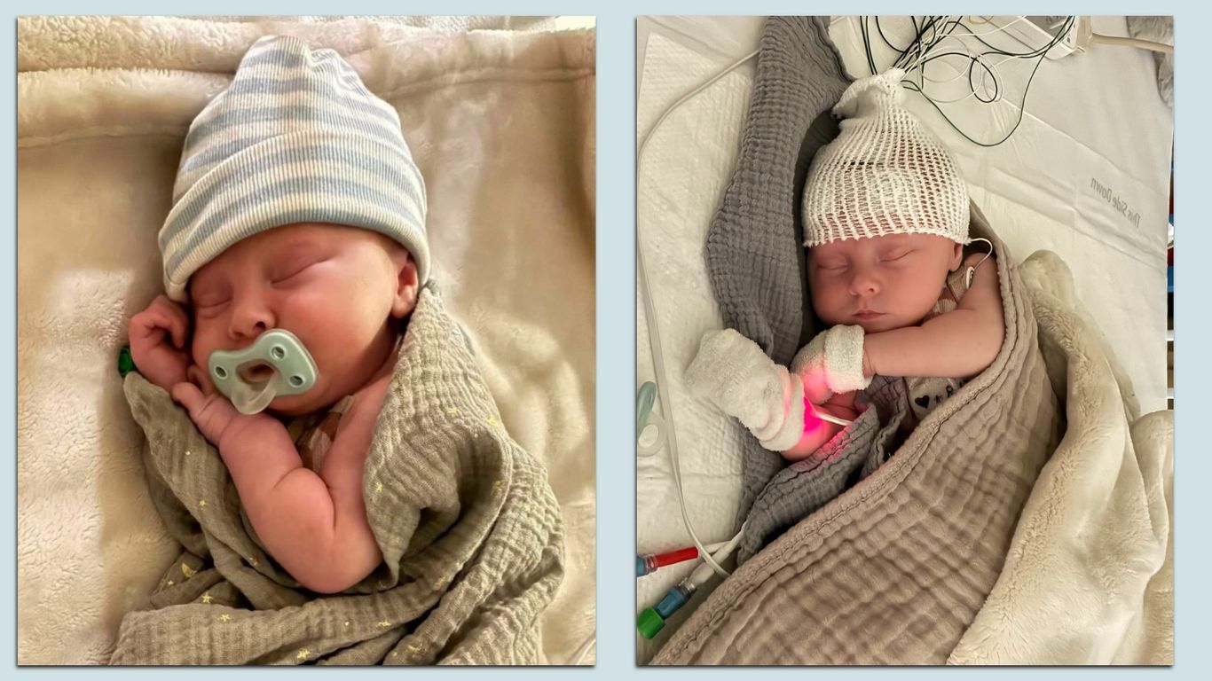 Greencastle infant at Riley Children's Hospital with rare genetic condition